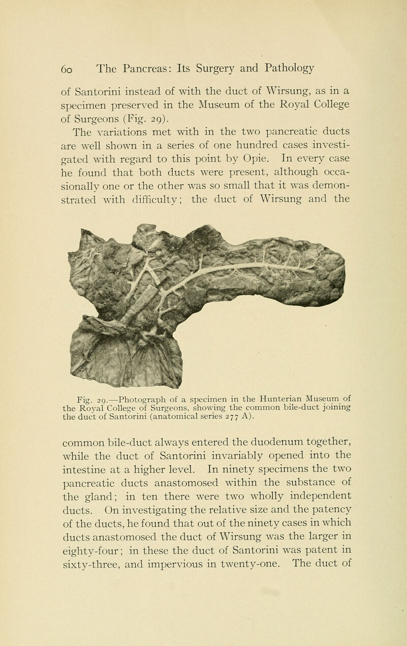 of Santorini instead of with the duct of Wirsung, as in a specimen preserved in the Museum of the Royal College of Surgeons (Fig. 29). The A^ariations met with in the two pancreatic ducts are well shown in a series of one hundred cases investi- gated with regard to this point by Opie. In every case he found that both ducts were present, although occa- sionally one or the other was so small that it was demon- strated with difficulty; the duct of Wirsung and the Fig. 29.—Photograph of a specimen in the Hunterian Museum of the Royal College of Surgeons, showing the common bile-duct joining the duct of Santorini (anatomical series 277 A). common bile-duct always entered the duodenum together, while the duct of Santorini invariably opened into the intestine at a higher level. In ninety specimens the two pancreatic ducts anastomosed within the substance of the gland; in ten there were two wholly independent ducts. On investigating the relative size and the patency of the ducts, he found that out of the ninety cases in which ducts anastomosed the duct of Wirsung was the larger in eighty-four; in these the duct of Santorini was patent in sixty-three, and impervious in twenty-one. The duct of