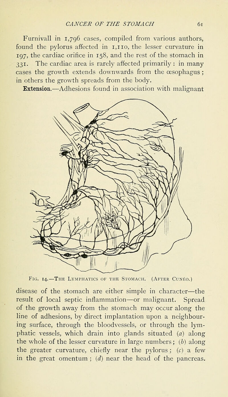 Furnivall in 1,796 cases, compiled from various authors, found the pylorus affected in i,tio, the lesser curvature in 197, the cardiac orifice in 158, and the rest of the stomach in 331, The cardiac area is rarely affected primarily : in many cases the growth extends downwards from the oesophagus ; in others the growth spreads from the body. Extension.—Adhesions found in association with malignant Fig. 14.—The Lymphatics of the Stomach. (After Cun^o. disease of the stomach are either simple in character—the result of local septic inflammation—or malignant. Spread of the growth away from the stomach may occur along the line of adhesions, by direct implantation upon a neighbour- ing surface, through the bloodvessels, or through the lym- phatic vessels, which drain into glands situated {a) along the whole of the lesser curvature in large numbers; {h) along the greater curvature, chiefly near the pylorus; (c) a few in the great omentum ; (i) near the head of the pancreas.