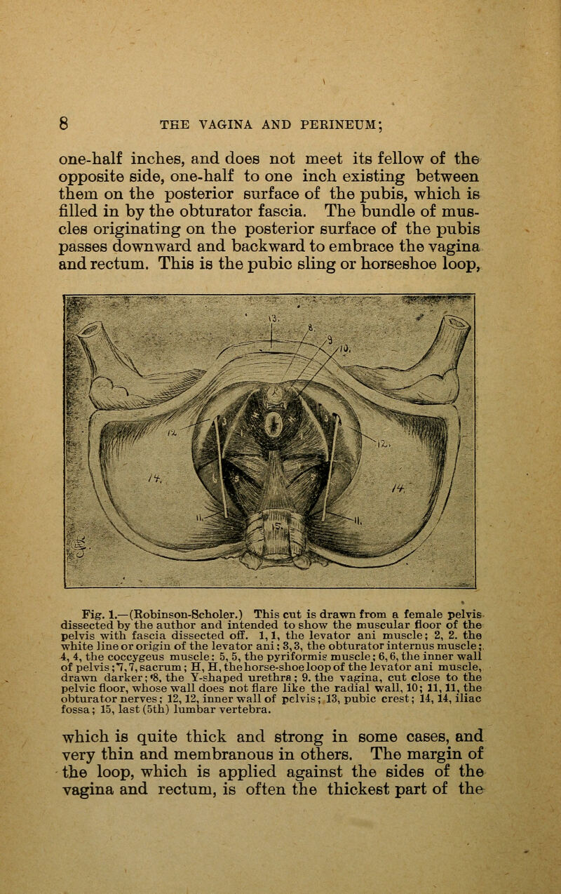 one-half inches, and does not meet its fellow of the opposite side, one-half to one inch existing between them on the posterior surface of the pubis, which is filled in by the obturator fascia. The bundle of mus- cles originating on the posterior surface of the pubis passes downward and backward to embrace the vagina and rectum. This is the pubic sling or horseshoe loop, Fig. 1.—(Robinson-Scholer.) This cut is drawn from a female pelvis dissected by the author and intended to show the muscular floor of the pelvis with fascia dissected off. 1,1, the levator ani muscle; 2, 2. the white line or origin of the levator ani; 8,3, the obturator internus muscle;, 4, 4, the coccygeus muscle: 5, 5, the pyriformis muscle; 6,6, the inner wall of pelvis; 7,7, sacrum; H, H, the horse-shoe loop of the levator ani muscle, drawn darker;«8. the Y-shaped urethra; 9. the vagina, cut close to the pelvic floor, whose wall does not flare like the radial wall, 10; 11,11, the obturator nerves; 12,12, inner wall of pelvis; 13, pubic crest; 14,14, iliac fossa; 15, last (5th) lumbar vertebra. which is quite thick and strong in some cases, and very thin and membranous in others. The margin of the loop, which is applied against the sides of the vagina and rectum, is often the thickest part of the