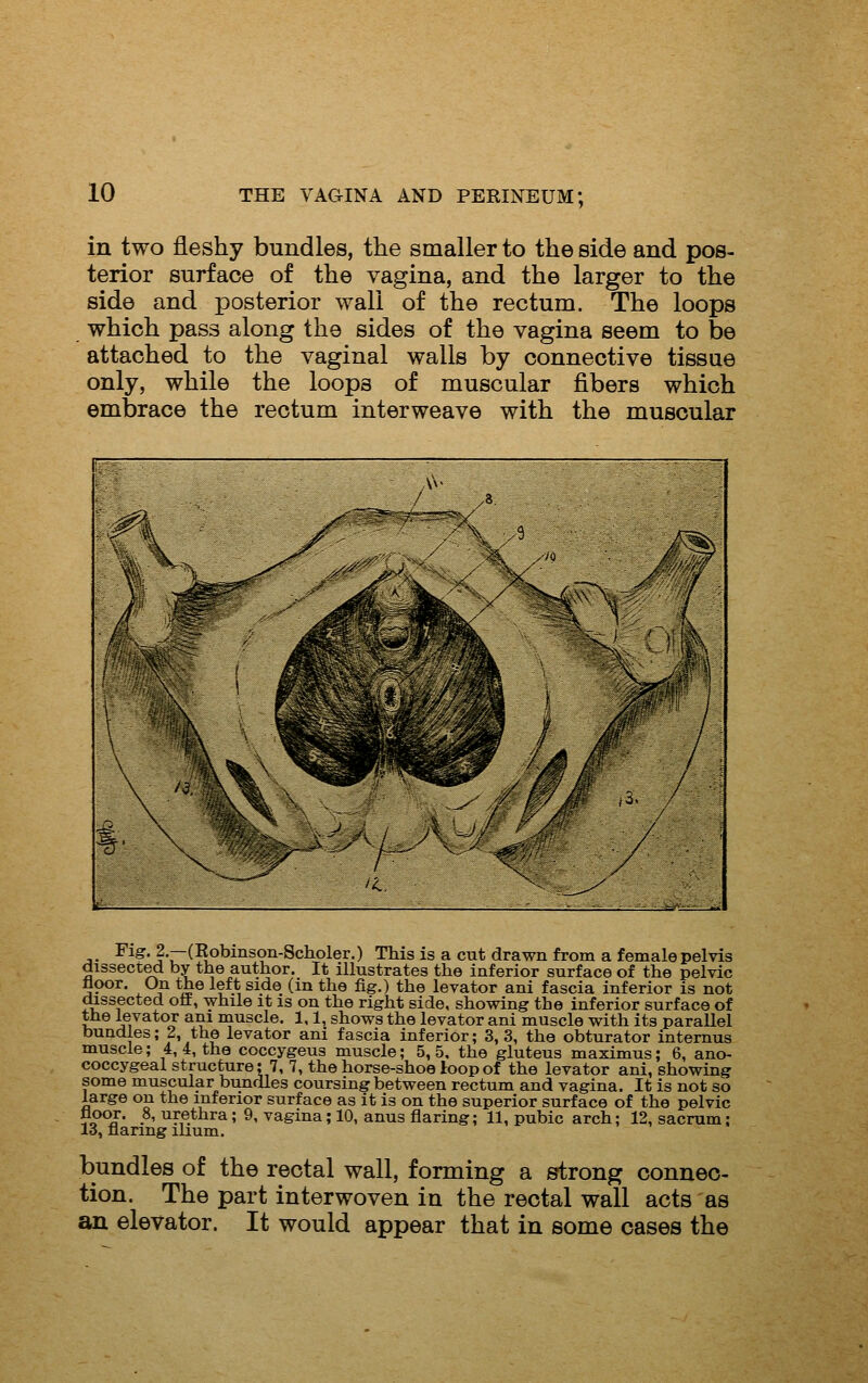 in two fleshy bundles, the smaller to the side and pos- terior surface of the vagina, and the larger to the side and posterior wall of the rectum. The loops which pass along the sides of the vagina seem to be attached to the vaginal walls by connective tissue only, while the loops of muscular fibers which embrace the rectum interweave with the muscular jii^ '-  ->.- -»- ■ - -^^ ->^-^~' ^' Fig. 2.—(Robinsoii-8ch.oler.) This is a cut drawn from a female pelvis dissected by the author. It illustrates the inferior surface of the pelvic floor. 0_n the left side (m the fig.) the levator ani fascia inferior is not ^ssected oft, while it is on the right side, showing the inferior surface of the levator am muscle. 1,1, shows the levator ani muscle with its parallel bundles; 2, the levator ani fascia inferior; 3,3, the obturator internus muscle; 4, 4, the coccygeus muscle; 5,5. the gluteus maximus; 6, ano- coccygeal structure; 7, 7, the horse-shoe loop of the levator ani, showing some muscular bundles coursing between rectum and vagina. It is not so large on the inferior surface as it is on the superior surface of the pelvic V?^I' .81 urethra; 9, vagina; 10, anus flaring; 11, pubic arch; 12, sacrum; 13, flaring ilium. bundles of the rectal wall, forming a strong connec- tion. The part interwoven in the rectal wall acts as an elevator. It would appear that in some oases the