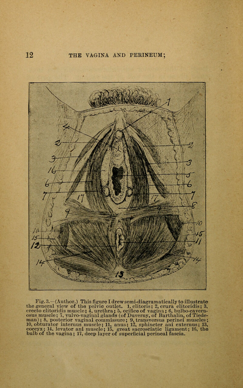 Fig. 3.—CAuthor.) This figure I drew semi-diagramatically to illustrate the general view of the pelvic outlet. 1, clitoris; 2, crura clitoridis; 3, erecto clitoridis muscle; 4, urethra; 5. orifice of vagina; 6, bulbo-eavern- osus muscle; 7, yulvo-vaginal glands (of Duverny, of Barthalin, of Tiede- man); 8, posterior vaginal commissure; 9, transversus perinei muscles; 10, obturator internus muscle; 11, anus; 12, sphincter ani externus; 13, coccyx; 14, levator ani muscle; 15, great sacrosCiatic ligament; 16, the bulb of the vagina; 17, deep layer of superficial perineal fascia.