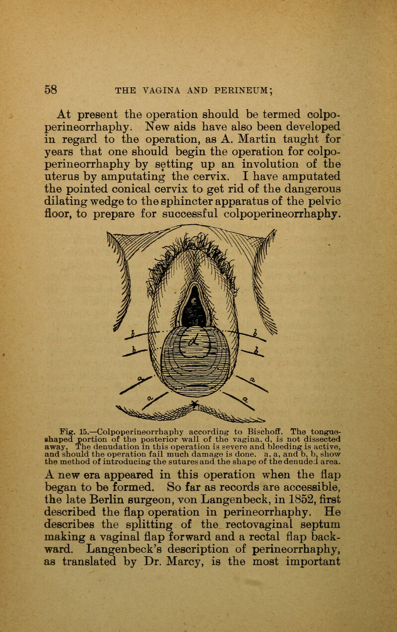 At present the operation should be termed oolpo- perineorrhaphy. New aids have also been developed in regard to the operation, as A. Martin taught for years that one should begin the operation for colpo- perineorrhaphy by setting up an involution of the uterus by amputating the cervix. I have amputated the pointed conical cervix to get rid of the dangerous dilating wedge to the sphincter apparatus of the pelvic floor, to prepare for successful colpoperineorrhaphy. Fig. 15.—Colpoperineorrhaphy according to Bischoff. The tongue- ehaped portion of the posterior wall of the vagina, d, is not dissected away. The denudation in this operation is severe and bleeding is active, and should the operation fail much damage is done, a, a, and b, b. show the method of introducing the sutures and the shape of the denuded area. A new era appeared in this operation when the flap began to be formed. So far as records are accessible, the late Berlin surgeon, von Langenbeck, in 1852, flrst described the flap operation in perineorrhaphy. He describes the splitting of the rectovaginal septum making a vaginal flap forward and a rectal flap back- ward. Langenbeck's description of perineorrhaphy, as translated by Dr. Marcy, is the most important