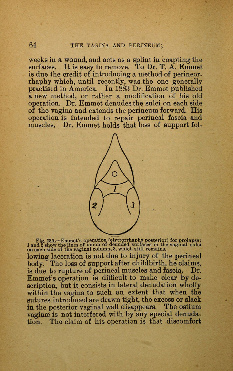 weeks in a wound, and acts as a splint in coapting the surfaces. It is easy to remove. To Dr. T. A. Emmet is due the credit of introducing a method of perineor- rhaphy which, until recently, was the one generally practised in America. In 1883 Dr. Emmet published a new method, or rather a modification of his old operation. Dr. Emmet denudes the sulci on each side of the vagina and extends the perineum forward. His operation is intended to repair perineal fascia and muscles. Dr. Emmet holds that loss of support fol- Fig. ISA.—Emmet's operation (elytrorrhaphy posterior) for prolapse: 1 and 2 show the lines of union of denuded surfaces in the vaginal sulci on each side of the vaginal column, 3, which still remains. lowing laceration is not due to injury of the perineal body. The loss of support after childbirth, he claims, is due to rupture of perineal muscles and fascia. Dr. Emmet's operation is difficult to make clear by de- scription, but it consists in lateral denudation wholly within the vagina to s-uch an extent that when the sutures introduced are drawn tight, the excess or slack in the posterior vaginal wall disappears. The ostium vaginse is not interfered with by any special denuda- tion. The claim of his operation is that discomfort