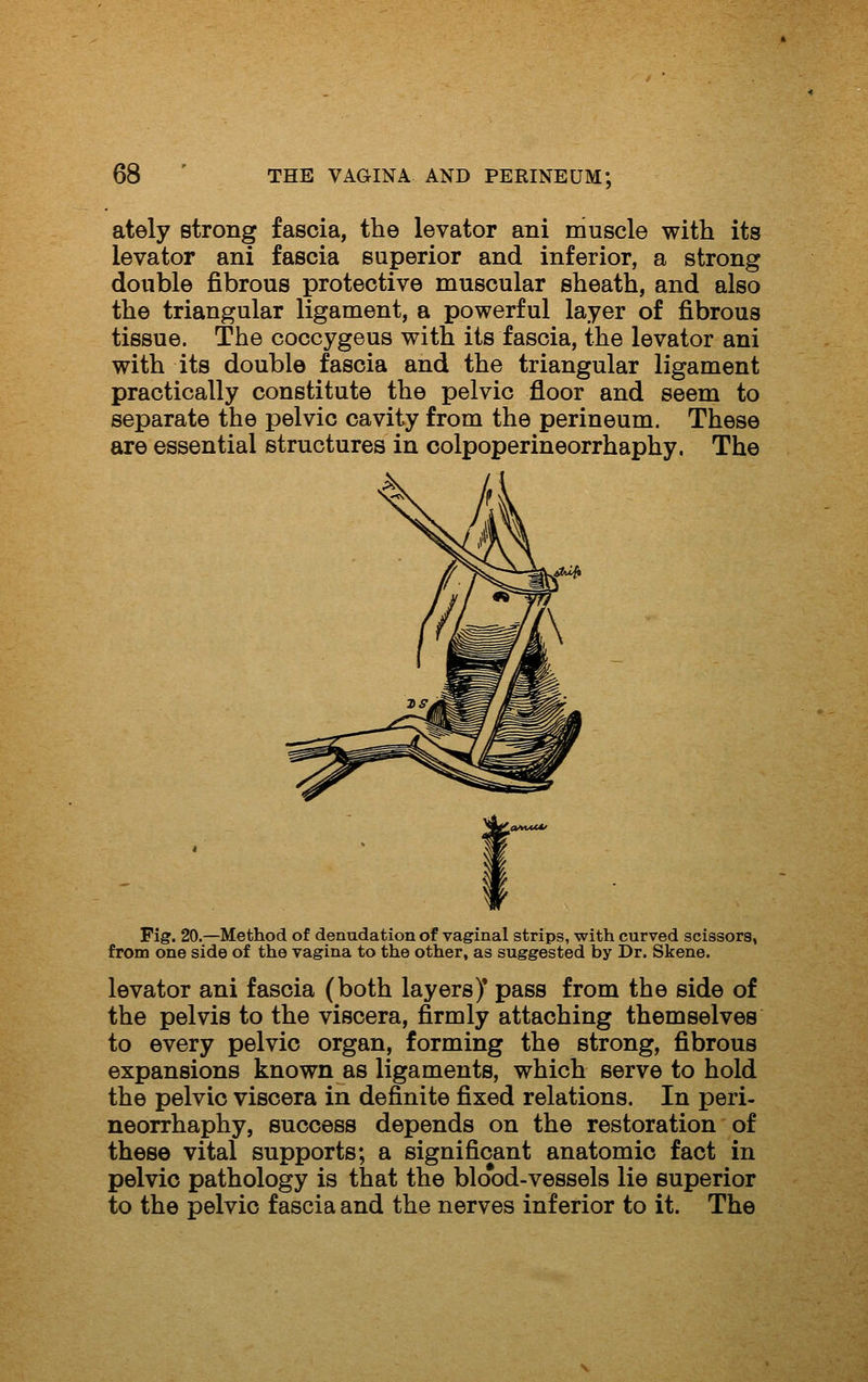 ately strong fascia, the levator ani muscle with its levator ani fascia superior and inferior, a strong double fibrous protective muscular sheath, and also the triangular ligament, a powerful layer of fibrous tissue. The coccygeus with its fascia, the levator ani with its double fascia and the triangular ligament practically constitute the pelvic floor and seem to separate the pelvic cavity from the perineum. These are essential structures in oolpoperineorrhaphy. The Fig. 20.—Method of denudation of vaginal strips, with curved scissors, from one side of the vagina to the other, as suggested by Dr. Skene. levator ani fascia (both layers)* pass from the side of the pelvis to the viscera, firmly attaching themselves to every pelvic organ, forming the strong, fibrous expansions known as ligaments, which serve to hold the pelvic viscera in definite fixed relations. In peri- neorrhaphy, success depends on the restoration of these vital supports; a significant anatomic fact in pelvic pathology is that the blo*od-vessels lie superior to the pelvic fascia and the nerves inferior to it. The