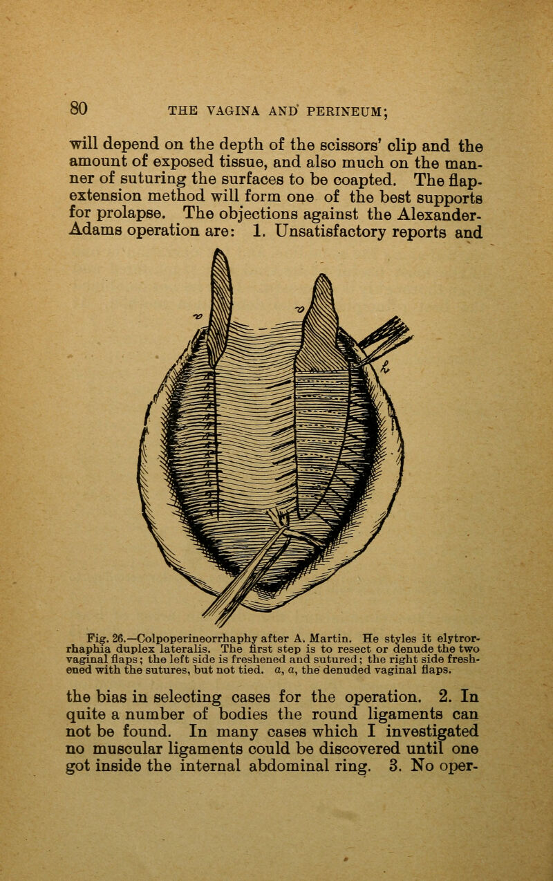 will depend on the depth of the scissors' clip and the amount of exposed tissue, and also much on the man- ner of suturing the surfaces to be coapted. The flap- extension method will form one of the best supports for prolapse. The objections against the Alexander- Adams operation are: 1. Unsatisfactory reports and Fig. 26.—Colpoperineorrhaphy after A. Martin, He styles it elytror- rhaphia duplex lateralis. The first step is to resect or denude the two vaginal flaps; the left side is freshened and sutured; the right side fresh- ened with the sutures, but not tied, a, a, the denuded vaginal flaps. the bias in selecting cases for the operation. 2. In quite a number of bodies the round ligaments can not be found. In many cases which I investigated no muscular ligaments could be discovered until one got inside the internal abdominal ring. 3. No oper-