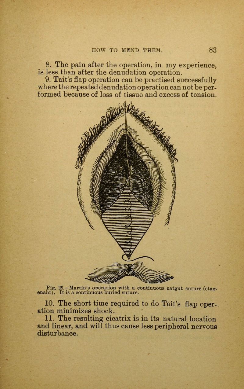 8. The pain after the operation, in my experience, is less than after the denudation operation. 9. Tait's flap operation can be practised successfully where the repeated denudation operation can not be per- formed because of loss of tissue and excess of tension. Fig. 28.—Martin's operation with a continuous catgrut suture (etagr- enaht). It is a continuous buried suture. 10. The short time required to do Tait's flap oper- ation minimizes shock. 11. The resulting cicatrix is in its natural location and linear, and will thus cause less peripheral nervous disturbance.