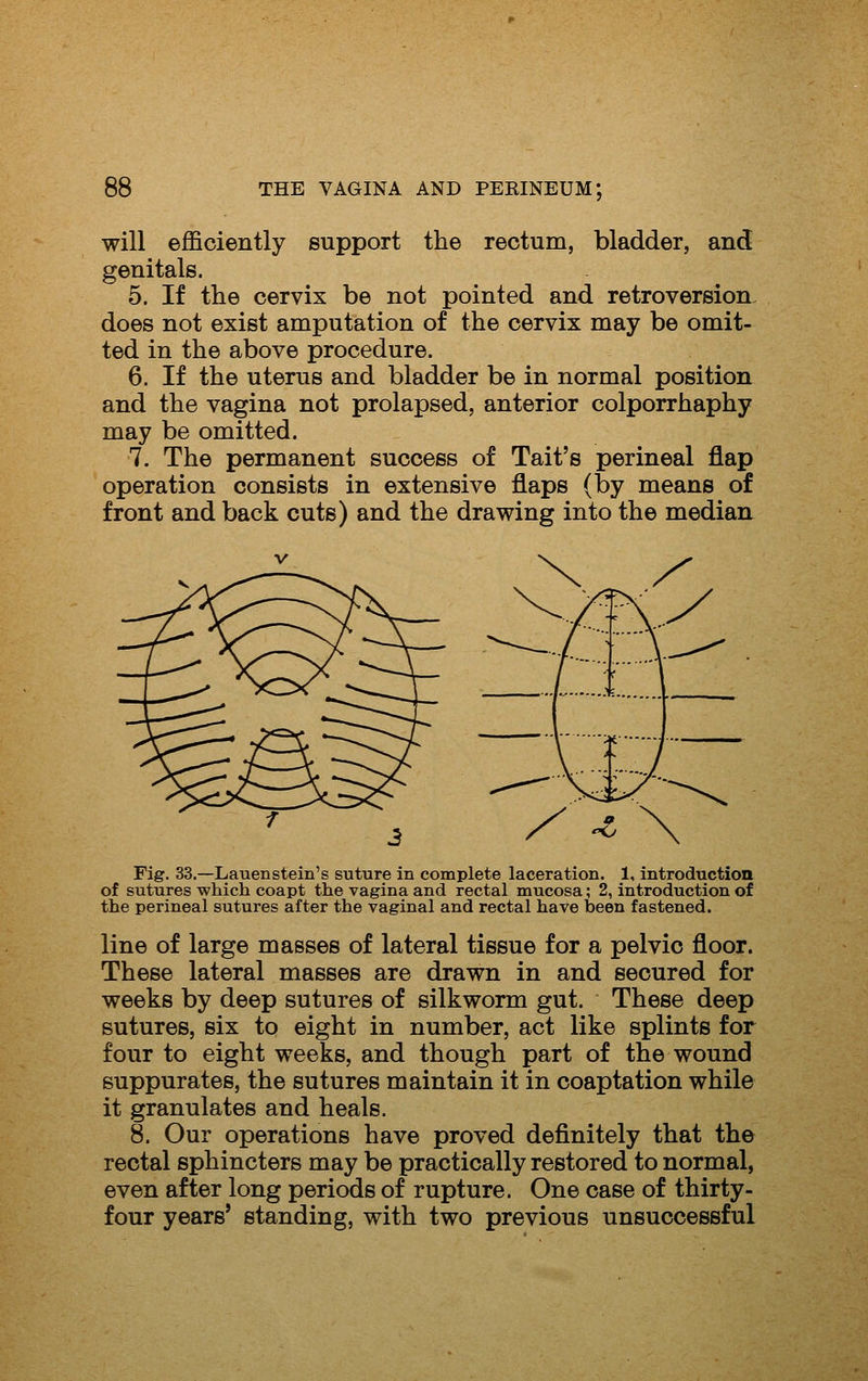 will efficiently support the rectum, bladder, and genitals. 5. If the cervix be not pointed and retroversion does not exist amputation of the cervix may be omit- ted in the above procedure. 6. If the uterus and bladder be in normal position and the vagina not prolapsed, anterior colporrhaphy may be omitted. 7. The permanent success of Tait's perineal flap operation consists in extensive flaps (by means of front and back cuts) and the drawing into the median Fig. 33.—Lauenstein's suture in complete laceration. 1, introduction of sutures which coapt the vagina and rectal mucosa; 2, introduction of the perineal sutures after the vaginal and rectal have been fastened. line of large masses of lateral tissue for a pelvic floor. These lateral masses are drawn in and secured for weeks by deep sutures of silkworm gut. These deep sutures, six to eight in number, act like splints for four to eight weeks, and though part of the wound suppurates, the sutures maintain it in coaptation while it granulates and heals. 8. Our operations have proved definitely that the rectal sphincters may be practically restored to normal, even after long periods of rupture. One case of thirty- four years' standing, with two previous unsuccessful