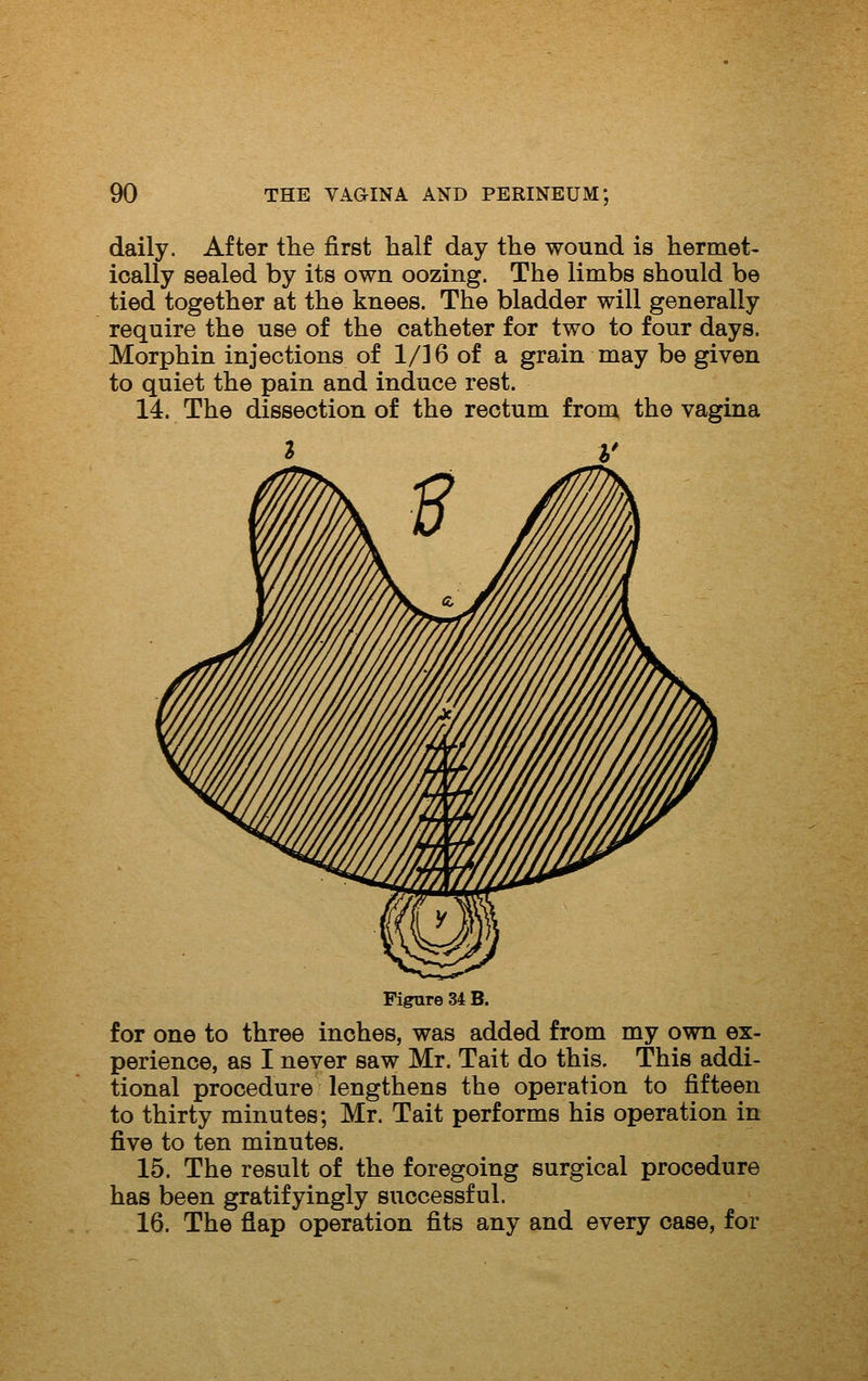 daily. After the first half day the wound is hermet- ically sealed by its own oozing. The limbs should be tied together at the knees. The bladder will generally require the use of the catheter for two to four days. Morphin injections of 1/16 of a grain may be given to quiet the pain and induce rest. 14. The dissection of the rectum from the vagina Figure 34 B. for one to three inches, was added from my own ex- perience, as I never saw Mr. Tait do this. This addi- tional procedure lengthens the operation to fifteen to thirty minutes; Mr. Tait performs his operation in five to ten minutes. 15. The result of the foregoing surgical procedure has been gratifyingly successful. 16. The flap operation fits any and every case, for