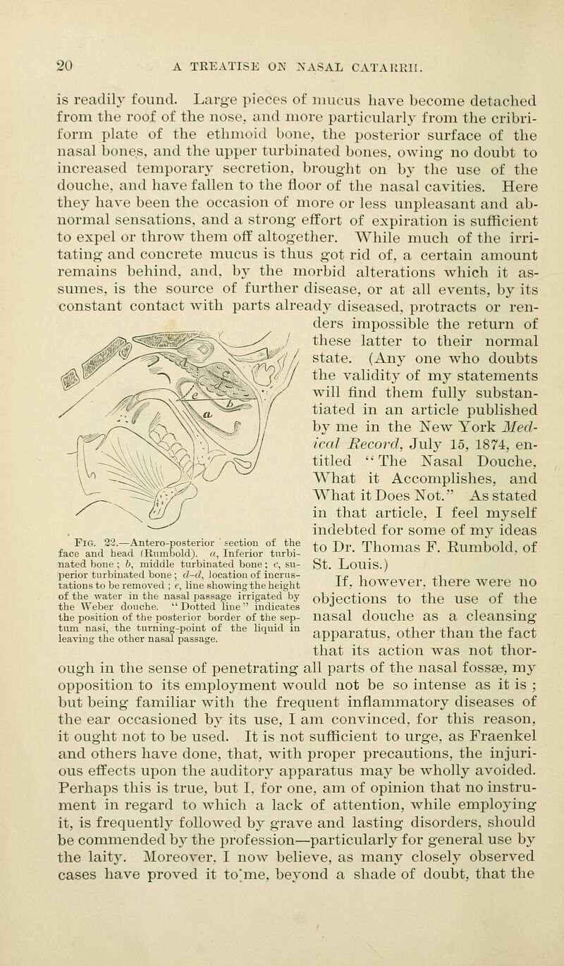 is readily found. Large pieces of iimcus have become detached from tlie roof of the nose, and more particukirly from the cribri- form plate of the ethmoid bone, the posterior surface of the nasal bones, and the upper turbinated bones, owing no doubt to increased temporary secretion, brought on by the use of the douche, and have fallen to the floor of the nasal cavities. Here they have been the occasion of more or less unpleasant and ab- normal sensations, and a strong effort of expiration is sufficient to expel or throw them off altogether. While much of the irri- tating and concrete mucus is thus got rid of, a certain amount remains behind, and, by the morbid alterations which it as- sumes, is the source of further disease, or at all events, by its constant contact with parts already diseased, protracts or ren- ders impossible the return of these latter to their normal state. (Any one who doubts the validity of my statements will find them fully substan- tiated in an article published by me in the New York Med- ical Record, July 15, 1874, en- titled The Nasal Douche, What it Accomplishes, and What it Does Not. As stated in that article, I feel myself indebted for some of my ideas to Dr. Thomas F. Rumbold, of St, Louis.) If, however, there were no objections to the use of the nasal douche as a cleansing apparatus, other than the fact that its action was not thor- ough in the sense of penetrating all parts of the nasal fossEe, my opposition to its employment would not be so intense as it is ; but being familiar with the frequent inflammatory diseases of the ear occasioned by its use, I am convinced, for this reason, it ought not to be used. It is not sufficient to urge, as Fraenkel and others have done, that, with proper precautions, the injuri- ous effects upon the auditory apparatus may be wholly avoided. Perhaps this is true, but I, for one, am of opinion that no instru- ment in regard to which a lack of attention, while employing it, is frequently followed by grave and lasting disorders, should be commended by the profession—particularly for general use by the laity. Moreover, I now believe, as many closely observed cases have proved it to'me, beyond a shade of doubt, that the Fig. 22.—Antero-posterior ' section of the face and head (Rumbold). «, Inferior turbi- nated bone ; b, middle turbinated bone; t', su- perior turbinated bone ; d-d, location of incrus- tations to be removed ; e, line showing the height of the water in the nasal passage irrigated by the Weber douche. Dotted line indicates the position of the posterior border of the sep- tum nasi, the turning-point of the liquid in leaving the other nasal passage.