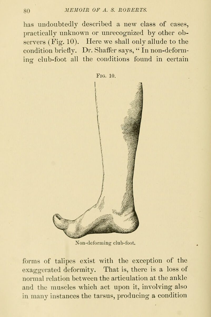 has undoubtedly described a new class of cases, practically unknown or unrecognized by other ob- servers (Fig. 10). Here we shall only allude to the condition briefly. Dr. Shaffer says,  In non-deform- ino- club-foot all the conditions found in certain Fjg. 10. Non-deforming club-foot. forms of talipes exist with the exception of the exaggerated deformity. That is, there is a loss of normal relation between the articulation at the ankle and the muscles which act upon it, involving also in many instances the tarsus, producing a condition