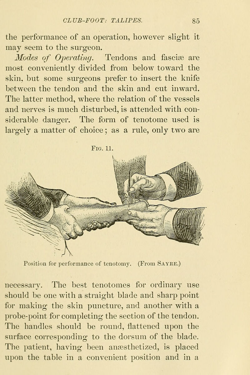 the performance of an operation, however slight it may seem to the surgeon. Modes of Operating. Tendons and fasciae are most conveniently divided from below toward the skin, but some surgeons prefer to insert the knife between the tendon and the skin and cut inward. The latter method, where the relation of the vessels and nerves is much disturbed, is attended with con- siderable danger. The form of tenotome used is largely a matter of choice; as a rule, only two are Fig. 11. Position for performance of tenotomy. (From Sayre.) necessary. The best tenotomes for ordinary use should be one with a straight blade and sharp point for making the skin puncture, and another with a probe-point for completing the section of the tendon. The handles should be round, flattened upon the surface corresponding to the dorsum of the blade. The patient, having been anesthetized, is placed upon the table in a convenient position and in a