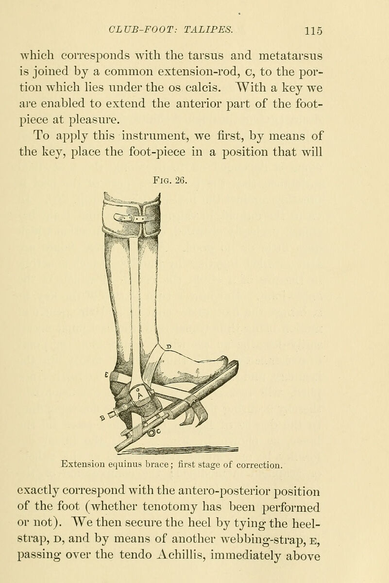 which corresponds with the tarsus and metatarsus is joined by a common extension-rod, c, to the por- tion which lies under the os calcis. With a key we are enabled to extend the anterior part of the foot- piece at pleasure. To apply this instrument, we first, by means of the key, place the foot-piece in a position that will Fig. 26. Extension equinus brace; first stage of correction. exactly correspond with the antero-posterior position of the foot (whether tenotomy has been performed or not). We then secure the heel by tying the heel- strap, d, and by means of another Avebbing-strap, e, passing over the tendo Achillis, immediately above