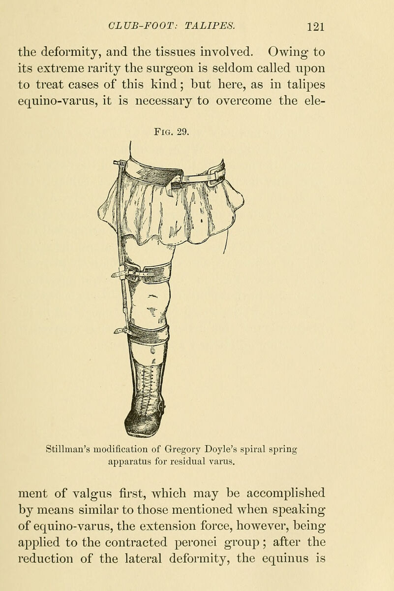 the deformity, and the tissues involved. Owing to its extreme rarity the surgeon is seldom called upon to treat cases of this kind; but here, as in talipes equino-varus, it is necessary to overcome the ele- FlG. 29. Stillman's modification of Gregory Doyle's spiral spring apparatus for residual varus. ment of valgus first, which may be accomplished by means similar to those mentioned when speaking of equino-varus, the extension force, however, being applied to the contracted peronei group; after the reduction of the lateral deformity, the equinus is