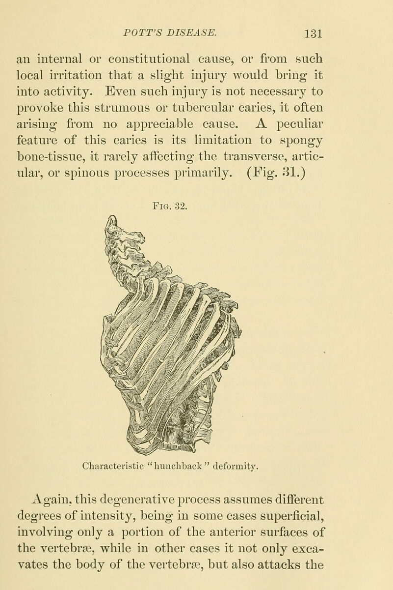 an internal or constitutional cause, or from such local irritation that a slight injury would bring it into activity. Even such injury is not necessary to provoke this strumous or tubercular caries, it often arising from no appreciable cause. A peculiar feature of this caries is its limitation to spongy bone-tissue, it rarely affecting the transverse, artic- ular, or spinous processes primarily. (Fig. 31.) Fig. 32. Characteristic  hunchback  deformity. Again, this degenerative process assumes different degrees of intensity, being in some cases superficial, involving only a portion of the anterior surfaces of the vertebrae, while in other cases it not only exca- vates the body of the vertebra?, but also attacks the