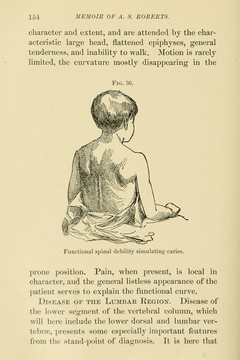 character and extent, and are attended by the char- acteristic large head, flattened epiphyses, general tenderness, and inability to walk. Motion is rarely limited, the curvature mostly disappearing in the Fig. 36. Functional spinal debility simulating caries. prone position. Pain, when present, is local in character, and the general listless appearance of the patient serves to explain the functional curve. Disease of the Lumbar Region. Disease of the lower segment of the vertebral column, which will here include the lower dorsal and lumbar ver- tebrae, presents some especially important features from the stand-point of diagnosis. It is here that