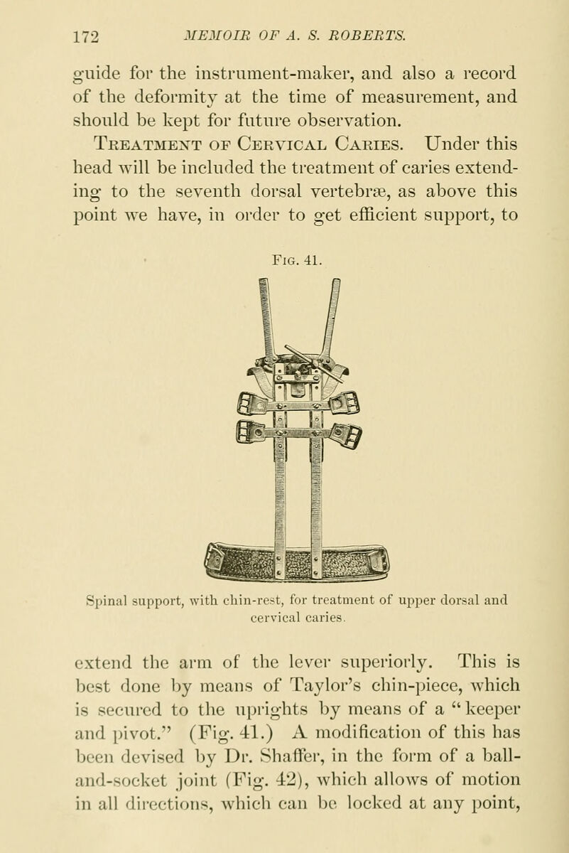 guide for the instrument-maker, and also a record of the deformity at the time of measurement, and should be kept for future observation. Treatment op Cervical Caries. Under this head will be included the treatment of caries extend- ing to the seventh dorsal vertebrae, as above this point we have, in order to get efficient support, to Fig. 41. ipM Spinal support, with chin-rest, for treatment of upper dorsal and cervical caries. extend the arm of the lever superiorly. This is best done by means of Taylor's chin-piece, which is secured to the uprights by means of a  keeper and pivot. (Fig. 41.) A modification of this has been devised by Dr. Shaffer, in the form of a ball- and-socket joint (Fig. 42), which allows of motion in all directions, which can be locked at any point,