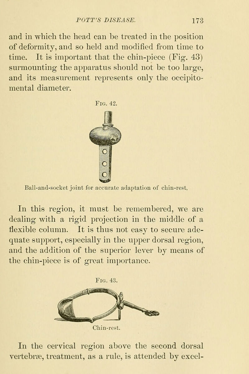 and in which the head can be treated in the position of deformity, and so held and modified from time to time. It is important that the chin-piece (Fig. 43) surmounting the apparatus should not be too large, and its measurement represents only the occipito- mental diameter. Fig. 42. Ball-and-socket joint for accurate adaptation of chin-rest, In this region, it must be remembered, we are dealing with a rigid projection in the middle of a flexible column. It is thus not easy to secure ade- quate support, especially in the upper dorsal region, and the addition of the superior lever by means of the chin-piece is of great importance. Fig. 43. Chin-rest. In the cervical region above the second dorsal vertebrae, treatment, as a rule, is attended by excel-