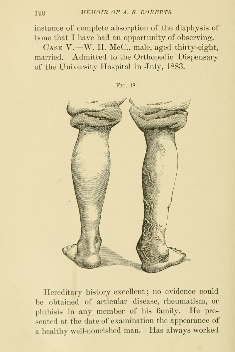 instance of complete absorption of the diaphysis of bone that I have had an opportunity of observing. Case V.—W. H. McC, male, aged thirty-eight, married. Admitted to the Orthopedic Dispensary of the University Hospital in July, 1883. Hereditary history excellent; no evidence could be obtained of articular disease, rheumatism, or phthisis in any member of his family. He pre- sented at the date of examination the appearance of a healthy well-nourished man. Has always worked