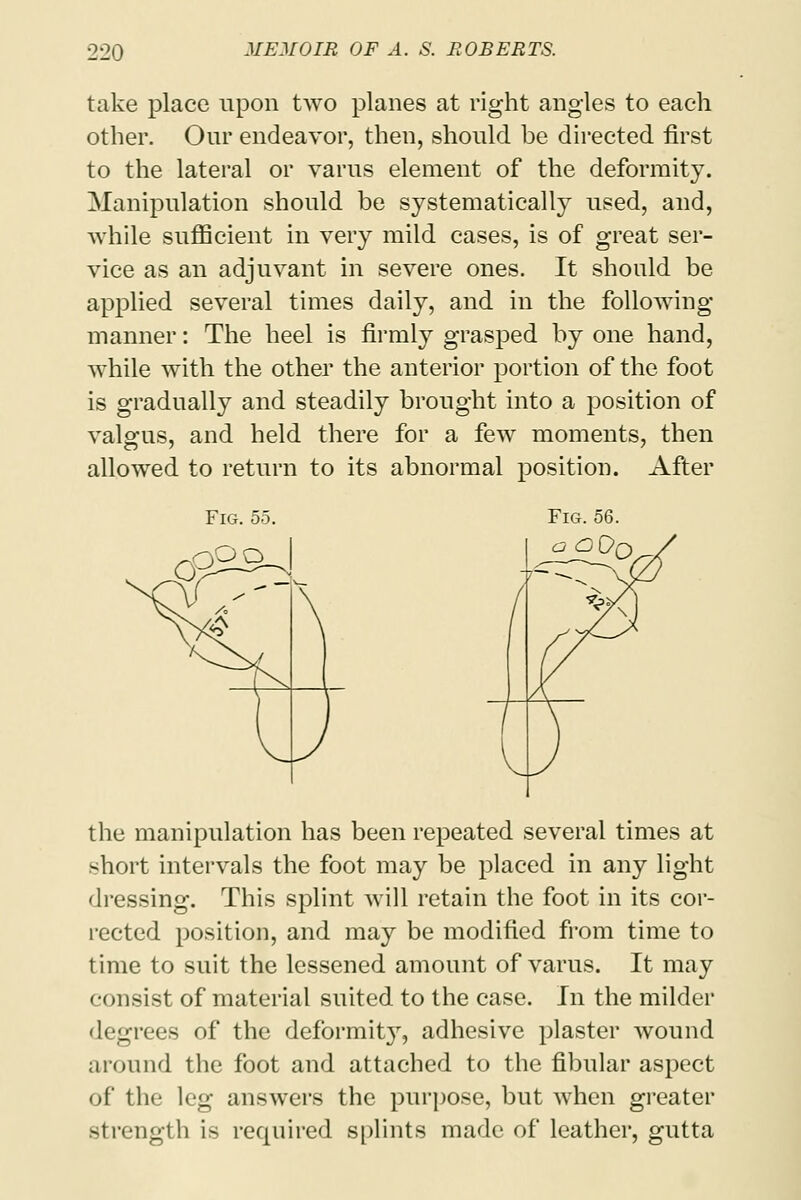 take place upon two planes at right angles to each other. Our endeavor, then, should be directed first to the lateral or varus element of the deformity. Manipulation should be systematically used, and, while sufficient in very mild cases, is of great ser- vice as an adjuvant in severe ones. It should be applied several times daily, and in the following manner: The heel is firmly grasped by one hand, while with the other the anterior portion of the foot is gradually and steadily brought into a position of valgus, and held there for a few moments, then allowed to return to its abnormal position. After Fig. 55. the manipulation has been repeated several times at short intervals the foot may be placed in any light dressing. This splint will retain the foot in its cor- rected position, and may be modified from time to time to suit the lessened amount of varus. It may consist of material suited to the case. In the milder degrees of the deformity, adhesive plaster wound around the foot and attached to the fibular aspect of the leg answers the purpose, but when greater Btrength is required splints made of leather, gutta