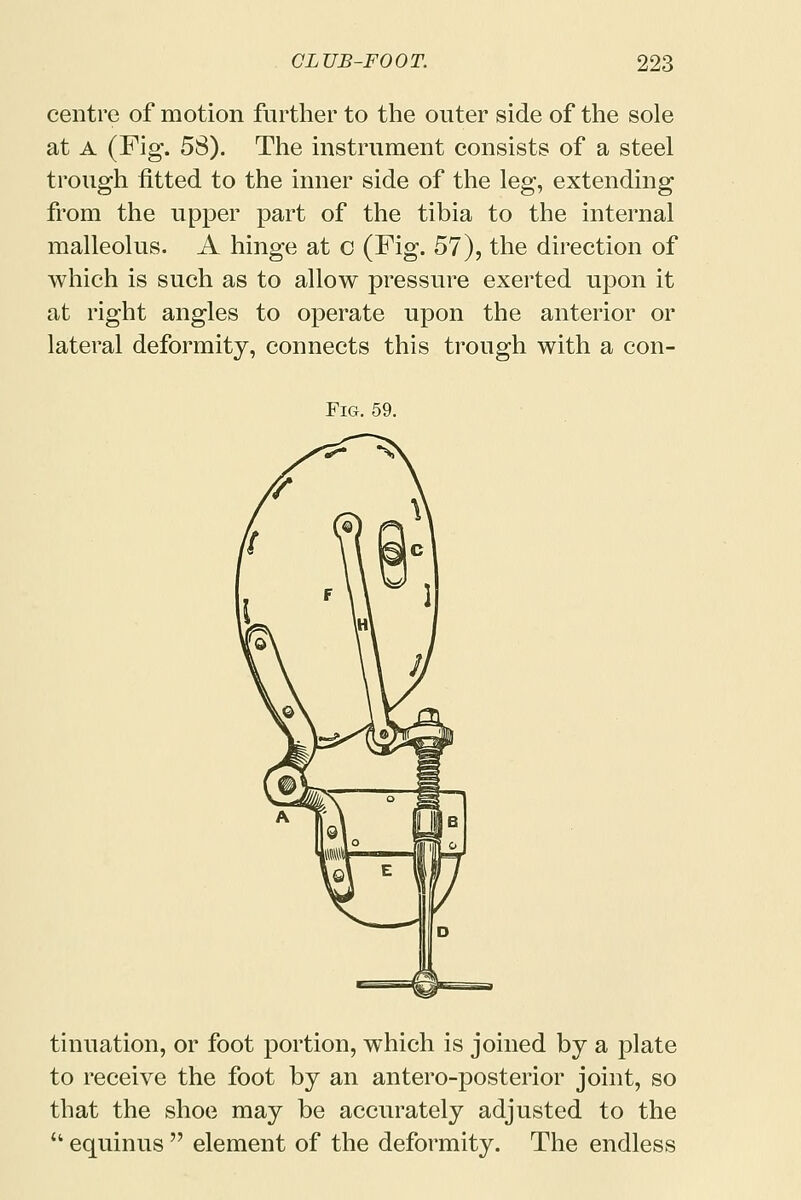 centre of motion further to the outer side of the sole at A (Fig. 58). The instrument consists of a steel trough fitted to the inner side of the leg, extending from the upper part of the tibia to the internal malleolus. A hinge at o (Fig. 57), the direction of which is such as to allow pressure exerted upon it at right angles to operate upon the anterior or lateral deformity, connects this trough with a con- tinuation, or foot portion, which is joined by a plate to receive the foot by an antero-posterior joint, so that the shoe may be accurately adjusted to the  equinus  element of the deformity. The endless