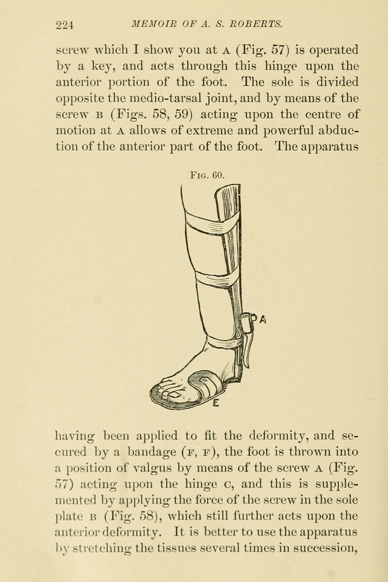 screw which I show you at A (Fig. 57) is operated by a key, and acts through this hinge upon the anterior portion of the foot. The sole is divided opposite the medio-tarsal joint, and by means of the screw b (Figs. 58, 59) acting upon the centre of motion at a allows of extreme and powerful abduc- tion of the anterior part of the foot. The apparatus Fig. 60. having been applied to fit the deformity, and se- cured by a bandage (f, f), the foot is thrown into a position of valgus by means of the screw A (Fig. 57) acting upon the hinge c, and this is supple- mented by applying the force of the screw in the sole plate b (Fig. 58), which still further acts upon the anterior deformity. It is better to use the apparatus by stretching the tissues several times in succession,