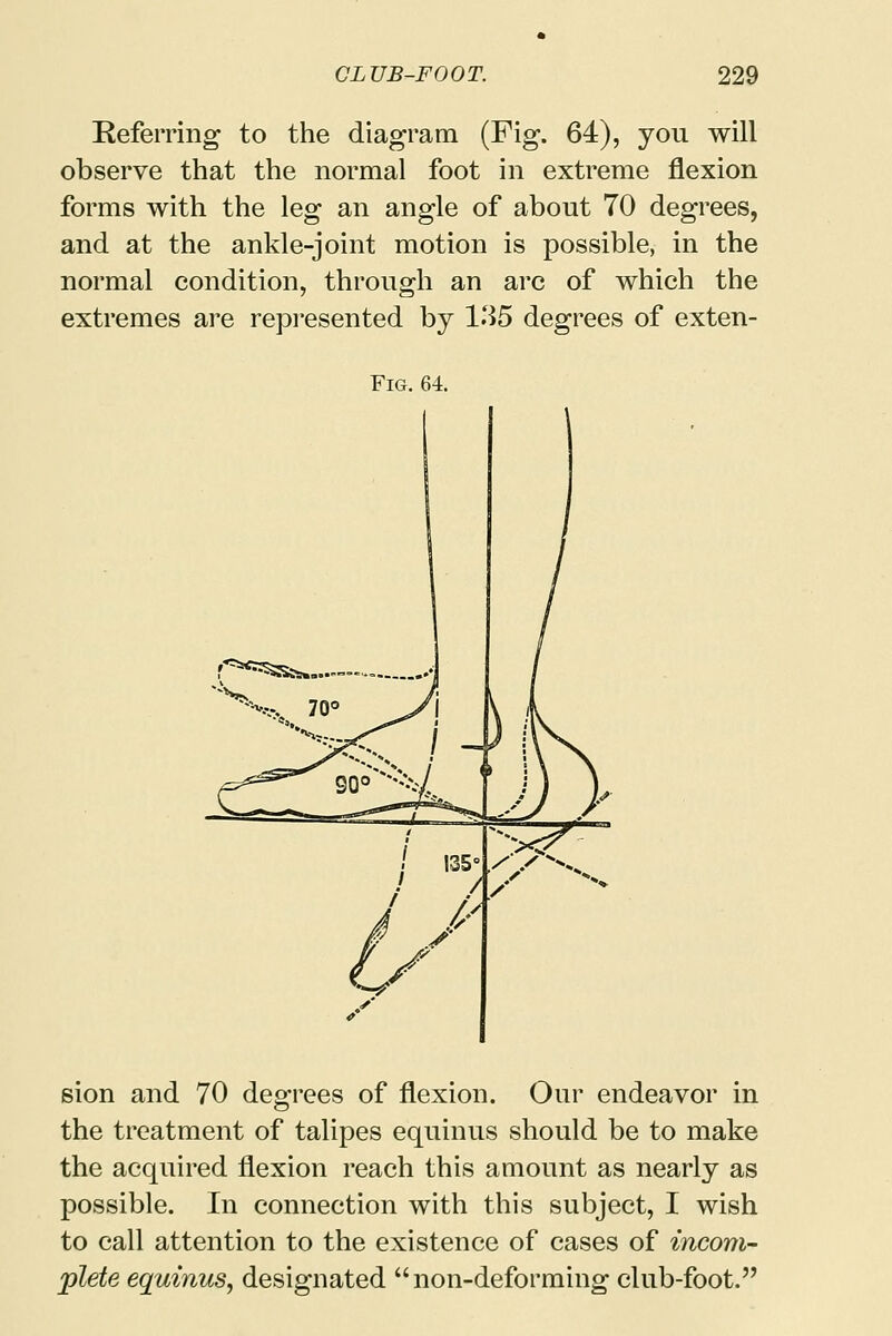 Referring to the diagram (Fig. 64), you will observe that the normal foot in extreme flexion forms with the leg an angle of about 70 degrees, and at the ankle-joint motion is possible, in the normal condition, through an arc of which the extremes are represented by 135 degrees of exten- Fig. 64. r**^^ sion and 70 degrees of flexion. Our endeavor in the treatment of talipes equinus should be to make the acquired flexion reach this amount as nearly as possible. In connection with this subject, I wish to call attention to the existence of cases of incom- plete equinus, designated non-deforming club-foot.