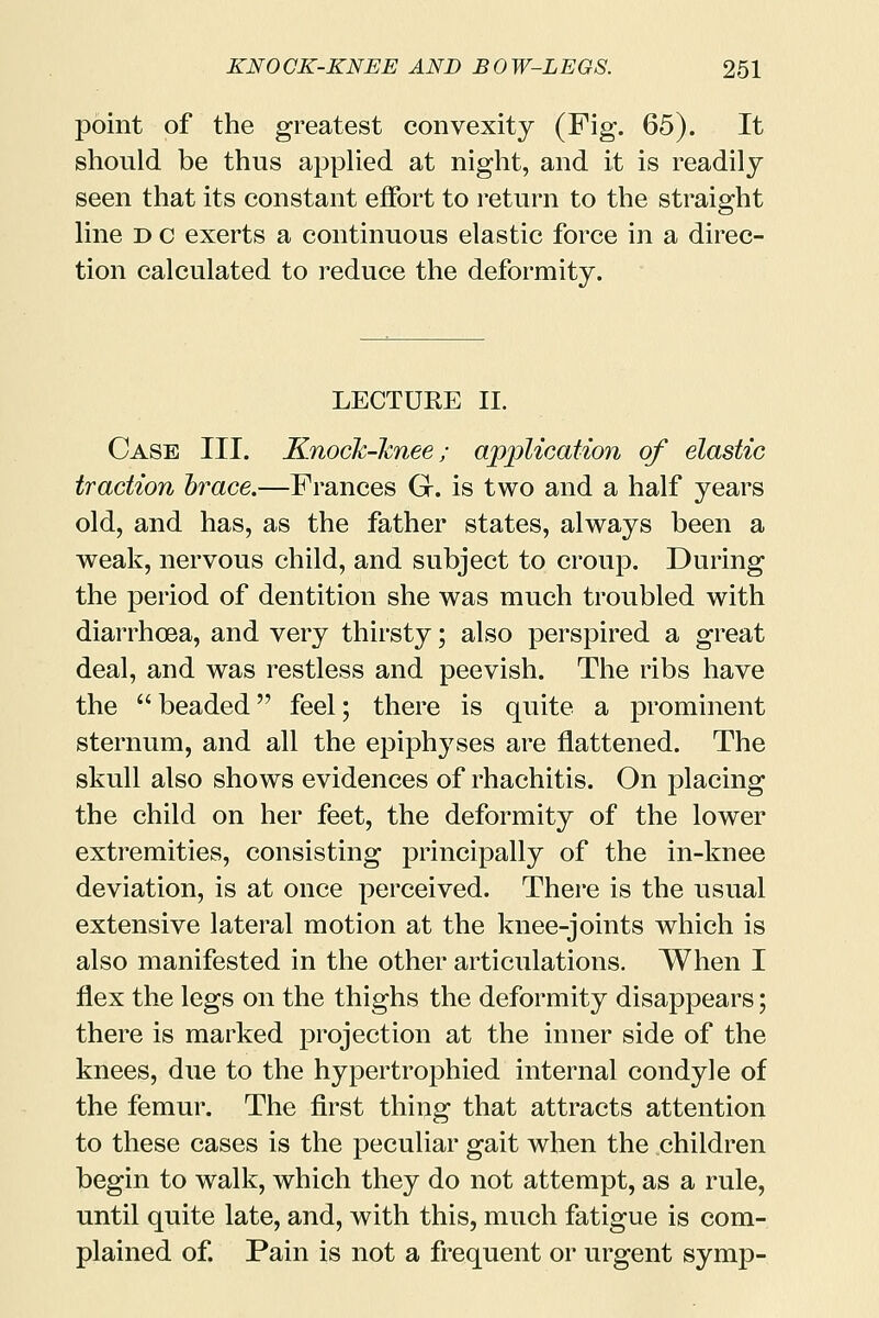 point of the greatest convexity (Fig. 65). It should be thus applied at night, and it is readily seen that its constant effort to return to the straight line d c exerts a continuous elastic force in a direc- tion calculated to reduce the deformity. LECTURE II. Case III. Knock-knee; application of elastic traction brace.—Frances G. is two and a half years old, and has, as the father states, always been a weak, nervous child, and subject to croup. During the period of dentition she was much troubled with diarrhoea, and very thirsty; also perspired a great deal, and was restless and peevish. The ribs have the  beaded feel; there is quite a prominent sternum, and all the epiphyses are flattened. The skull also shows evidences of rhachitis. On placing the child on her feet, the deformity of the lower extremities, consisting principally of the in-knee deviation, is at once perceived. There is the usual extensive lateral motion at the knee-joints which is also manifested in the other articulations. When I flex the legs on the thighs the deformity disappears; there is marked projection at the inner side of the knees, due to the hypertrophied internal condyle of the femur. The first thing that attracts attention to these cases is the peculiar gait when the children begin to walk, which they do not attempt, as a rule, until quite late, and, with this, much fatigue is com- plained of. Pain is not a frequent or urgent symp-