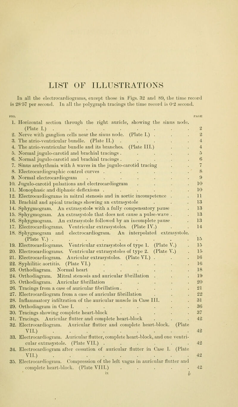 LIST OF ILLUSTRATIONS 111 all the electroi'jinliogiaius, except those in Figs. 32 ami 89, the time recoi-d is 2857 per second, lu all the polygraph tracings the time record is 0*2 second. 1. Horizontal section through the right nuricle, showing the .sinus nod (Plate I.) . . ' 2. Nerve with ganglion cells near the sinus node. (Plate I.) . 3. The atrio-ventricular bundle. (Plate II.) .... 4. The atrio-ventricular bundle and its branches. (Plate III.) 5. Normal jugulo-carotid and brachial tracings .... 6. Normal jugulo-carotid and brachial tracings . 7. Sinus arrhythmia with h waves in the jugulo-carotid tracing 8. Electrocardiographic control curves ..... 9. Normal electrocardiogram ...... 10. Jugulo-carotid pulsations and electrocardiogram 11. Monophasic and diphasic deflexions ..... 12. Electrocardiograms in mitral stenosis and in aortic incompetence . 13. Brachial and apical tracings showing an extrasystole 14. Sphygmogram. An extrasystole with a fully compensatory pause 15. Sphygmogram. An extrasystole that does not cause a pulse-wave . 16. Sphygmogram. An extrasystole followed by an incomplete pause 17. Electrocardiograms. Ventricular extrasystoles. (Plate IV.) 18. Sphygmogram and electrocardiogram. An interpolated extrasystole, (Plate V.) . 19. Electrocardiograms. Ventricular extrasystoles of type 1. (Plate V.) 20. Electrocardiograms. Ventricular extrasystoles of type 2. (Plate V.) 21. Electrocardiogram. Auricular extrasystoles. (Plate VI.) . 22. Syphilitic aortitis. (Plate VI.) ..... 23. Orthodiagram. Normal heart ..... 24. Orthodiagram. Mitral stenosis and auricular fibrillation . 25. Orthodiagram. Auricular fibrillation .... 26. Tracings from a case of auricular fibrillation.... 27. Electrocardiogram from a case of auricular fibrillation 28. Inflammatory infiltration of the auricular muscle in Case III. 29. Orthodiagram in Case I. ..... . 30. Tracings showing complete heart-block .... 31. Tracings. Auricular flutter and complete heart-block 32. Electrocardiogram. Auricular flutter and complete heart-block. (Plate VII.) 33. Electrocai'diogiam. Auricular flutter, complete heart-block, and one veiitri cular extrasystole. (Plate VII.) ..... 34. Electrocardiogram after cessation of auricular flutter in Case I. (Plate VII.) . . . . . . . 35. Electrocardiogram. Compression of the left vagus in auricular lluLter an complete heart-block. (Plate VIII.) .... 9 10^ 10 11 la 13 13 13 14 15 15 15. 16 16 18 19 20' 21 22 31 36 37 42 42 42 42 42