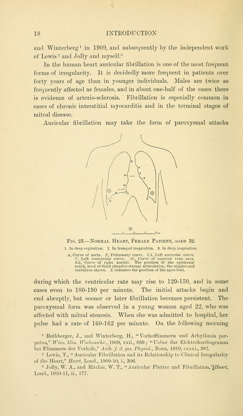 and Winterberg^ in 1909, and subsequently by the independent work of Lewis ^ and Jolly and myself.^ In the human heart auricular fibrillation is one of the most frequent forms of irregularity. It is decidedly more frequent in patients over forty years of age than in younger individuals. Males are twice as frequently affected as females, and in about one-half of the cases there is evidence of arterio-sclerosis. Fibrillation is especially common in cases of chronic interstitial myocarditis and in the terminal stages of mitral disease. Auricular fibrillation may take the form of paroxysmal attacks ®, Fig. 23.—NoRiiAL Heart, Female Patient, aged 32. 1. In deep expiration. 2. In tranquil inspiration. 3. In deep inspiration. A, Curve of aorta. P, Pulmonary curve. LA, Left auricular curve. V, Left ventricular curve. SC, Curve of superior vena. cava. JRA, Curve of right auricle. The position of the episternal notch, level of third chondro-sternal articulation, the nipples and umbilicus shown. X indicates the position of the apex-beat. during which the ventricular rate may rise to 120-150, and in some cases even to 180-190 per minute. The initial attacks begin and end abruptly, but sooner or later fibrillation becomes persistent. The paroxysmal form was observed in a young woman aged 22, who was affected with mitral stenosis. When she was admitted to hospital, her pulse had a rate of 160-162 per minute. On the following morning 1 Eothberger, J., and Winterberg, H.,  Vorhofflimmern uiid Arhythmia per- petua, Wie7i. Jclin. Wochenschr., 1909, xxii., 839 ;  Ueber das Elektrokardiogramm bei Flimmern der Vorhofe, Arch. f. d. ges. Physiol., Bonn, 1910, cxxxi., 387. 2 Lewis, T.,  Auricular Fibrillation and its Kelation.sliip to Clinical Irregularity of the Heart, Heart, Lond., 1909-10, i., 306. 3 Jolly, W. A., and Ritcbie, W. T., Auricular Flutter and Fibrillation,^£'ear^,. Lond., 1910-11, ii., 177.