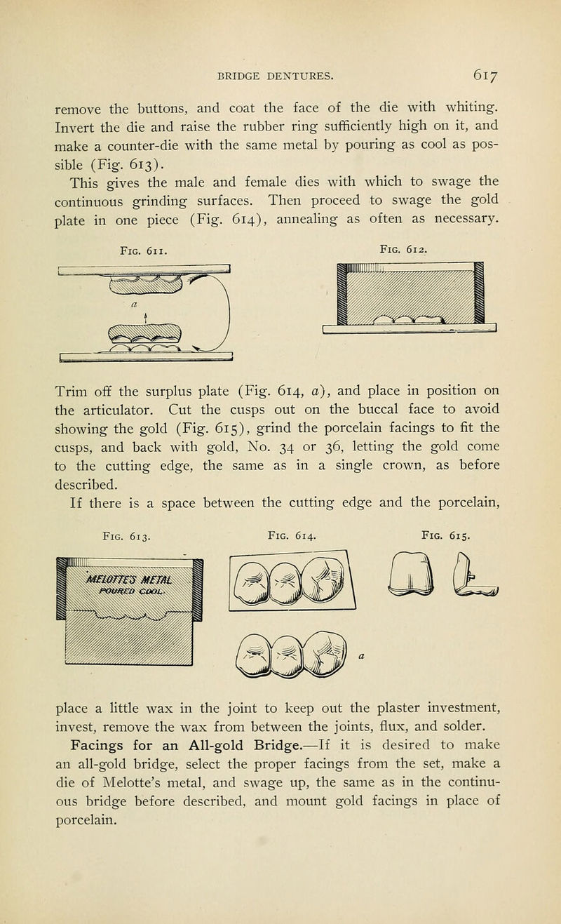 remove the buttons, and coat the face of the die with whiting. Invert the die and raise the rubber ring sufficiently high on it, and make a counter-die with the same metal by pouring as cool as pos- sible (Fig. 613). This gives the male and female dies with which to swage the continuous grinding surfaces. Then proceed to swage the gold plate in one piece (Fig. 614), annealing as often as necessary. Fig. 612. Fig. 6n. 1 =—=J a l %^~^<^^ 1 s^^~*^~~>s~^~*n v. ^y Trim off the surplus plate (Fig. 614, a), and place in position on the articulator. Cut the cusps out on the buccal face to avoid showing the gold (Fig. 615), grind the porcelain facings to fit the cusps, and back with gold, No. 34 or 36, letting the gold come to the cutting edge, the same as in a single crown, as before described. If there is a space between the cutting edge and the porcelain, Fig. 613. Fig. 614. Fig. 615. place a little wax in the joint to keep out the plaster investment, invest, remove the wax from between the joints, flux, and solder. Facings for an All-gold Bridge.—If it is desired to make an all-gold bridge, select the proper facings from the set, make a die of Melotte's metal, and swage up, the same as in the continu- ous bridge before described, and mount gold facings in place of porcelain.