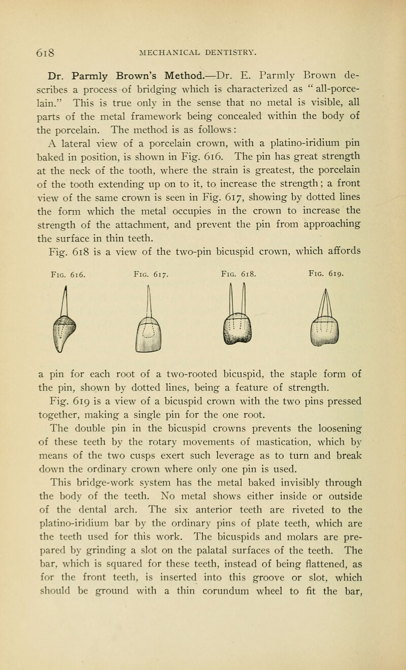 Dr. Parmly Brown's Method.—Dr. E. Parmly Brown de- scribes a process of bridging which is characterized as  all-porce- lain. This is true only in the sense that no metal is visible, all parts of the metal framework being concealed within the body of the porcelain. The method is as follows: A lateral view of a porcelain crown, with a platino-iridium pin baked in position, is shown in Fig. 616. The pin has great strength at the neck of the tooth, where the strain is greatest, the porcelain of the tooth extending up on to it, to increase the strength; a front view of the same crown is seen in Fig. 617, showing by dotted lines the form which the metal occupies in the crown to increase the strength of the attachment, and prevent the pin from approaching the surface in thin teeth. Fig. 618 is a view of the two-pin bicuspid crown, which affords Fig. 616. Fig. 617. Fig. 618. Fig. 619. a pin for each root of a two-rooted bicuspid, the staple form of the pin, shown by dotted lines, being a feature of strength. Fig. 619 is a view of a bicuspid crown with the two pins pressed together, making a single pin for the one root. The double pin in the bicuspid crowns prevents the loosening of these teeth by the rotary movements of mastication, which by means of the two cusps exert such leverage as to turn and break down the ordinary crown where only one pin is used. This bridge-work system has the metal baked invisibly through the body of the teeth. No metal shows either inside or outside of the dental arch. The six anterior teeth are riveted to the platino-iridium bar by the ordinary pins of plate teeth, which are the teeth used for this work. The bicuspids and molars are pre- pared by grinding a slot on the palatal surfaces of the teeth. The bar, which is squared for these teeth, instead of being flattened, as for tbe front teeth, is inserted into this groove or slot, which should be ground with a thin corundum wheel to fit the bar,