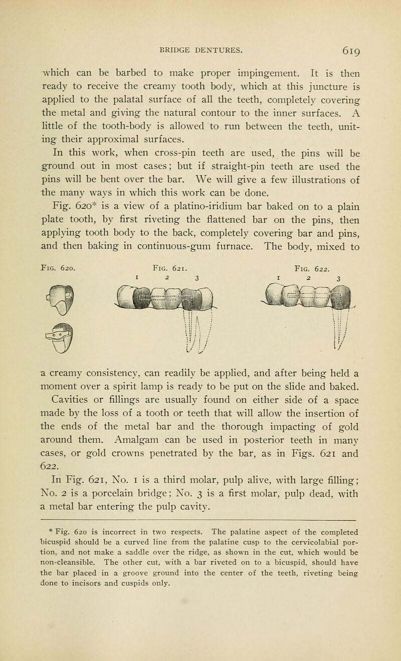 which can be barbed to make proper impingement. It is then ready to receive the creamy tooth body, which at this juncture is applied to the palatal surface of all the teeth, completely covering the metal and giving the natural contour to the inner surfaces. A little of the tooth-body is allowed to run between the teeth, unit- ing their approximal surfaces. In this work, when cross-pin teeth are used, the pins will be ground out in most cases; but if straight-pin teeth are used the pins will be bent over the bar. We will give a few illustrations of the many ways in which this work can be done. Fig. 620* is a view of a platino-iridium bar baked on to a plain plate tooth, by first riveting the flattened bar on the pins, then applying tooth body to the back, completely covering bar and pins, and then baking in continuous-gum furnace. The body, mixed to Pig. 620. Fig. 621. Fig. 622. !:.' a creamy consistency, can readily be applied, and after being held a moment over a spirit lamp is ready to be put on the slide and baked. Cavities or fillings are usually found on either side of a space made by the loss of a tooth or teeth that will allow the insertion of the ends of the metal bar and the thorough impacting of gold around them. Amalgam can be used in posterior teeth in many cases, or gold crowns penetrated by the bar, as in Figs. 621 and 622. In Fig. 621, No. 1 is a third molar, pulp alive, with large filling; No. 2 is a porcelain bridge; No. 3 is a first molar, pulp dead, with a metal bar entering the pulp cavity. * Fig. 620 is incorrect in two respects. The palatine aspect of the completed bicuspid should be a curved line from the palatine cusp to the cervicolabial por- tion, and not make a saddle over the ridge, as shown in the cut, which would be non-cleansible. The other cut, with a bar riveted on to a bicuspid, should have the bar placed in a groove ground into the center of the teeth, riveting being done to incisors and cuspids only.