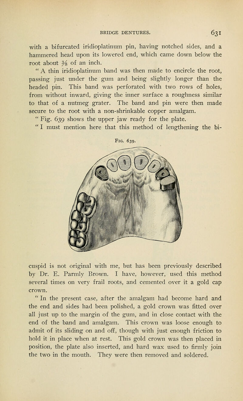 with a bifurcated iridioplatinum pin, having notched sides, and a hammered head upon its lowered end, which came down below the root about }i of an inch.  A thin iridioplatinum band was then made to encircle the root, passing just under the gum and being slightly longer than the headed pin. This band was perforated with two rows of holes, from without inward, giving the inner surface a roughness similar to that of a nutmeg grater. The band and pin were then made secure to the root with a non-shrinkable copper amalgam.  Fig. 639 shows the upper jaw ready for the plate.  I must mention here that this method of lengthening the bi- Fig. 639. cuspid is not original with me, but has been previously described by Dr. E. Parmly Brown. I have, however, used this method several times on very frail roots, and cemented over it a gold cap crown.  In the present case, after the amalgam had become hard and the end and sides had been polished, a gold crown was fitted over all just up to the margin of the gum, and in close contact with the end of the band and amalgam. This crown was loose enough to admit of its sliding on and off, though with just enough friction to hold it in place when at rest. This gold crown was then placed in position, the plate also inserted, and hard wax used to firmly join the two in the mouth. They were then removed and soldered.