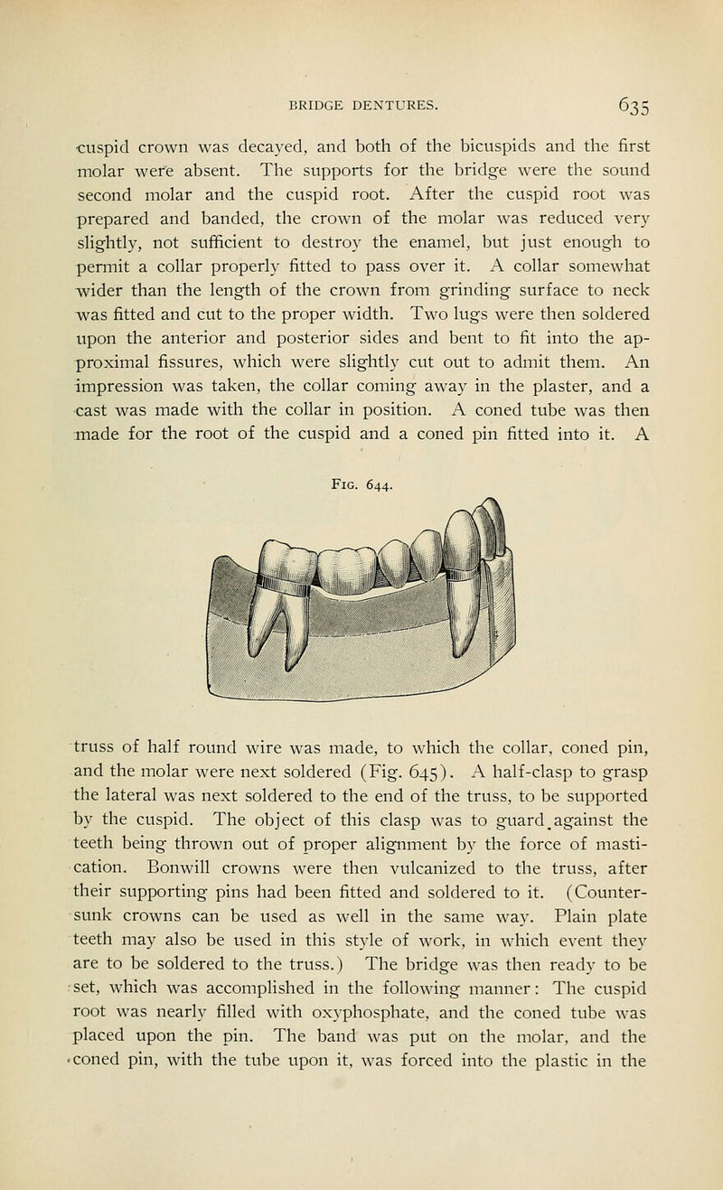 •cuspid crown was decayed, and both of the bicuspids and the first molar were absent. The supports for the bridge were the sound second molar and the cuspid root. After the cuspid root was prepared and banded, the crown of the molar was reduced very slightly, not sufficient to destroy the enamel, but just enough to permit a collar properly fitted to pass over it. A collar somewhat wider than the length of the crown from grinding surface to neck was fitted and cut to the proper width. Two lugs were then soldered upon the anterior and posterior sides and bent to fit into the ap- proximal fissures, which were slightly cut out to admit them. An impression was taken, the collar coming away in the plaster, and a cast was made with the collar in position. A coned tube was then made for the root of the cuspid and a coned pin fitted into it. A Fig. 644. truss of half round wire was made, to which the collar, coned pin, and the molar were next soldered (Fig. 645). A half-clasp to grasp the lateral was next soldered to the end of the truss, to be supported by the cuspid. The object of this clasp was to guard^against the teeth being thrown out of proper alignment by the force of masti- cation. Bonwill crowns were then vulcanized to the truss, after their supporting pins had been fitted and soldered to it. (Counter- sunk crowns can be used as well in the same way. Plain plate teeth may also be used in this style of work, in which event they are to be soldered to the truss.) The bridge was then ready to be set, which was accomplished in the following manner: The cuspid root was nearly filled with oxyphosphate, and the coned tube was placed upon the pin. The band was put on the molar, and the - coned pin, with the tube upon it, was forced into the plastic in the