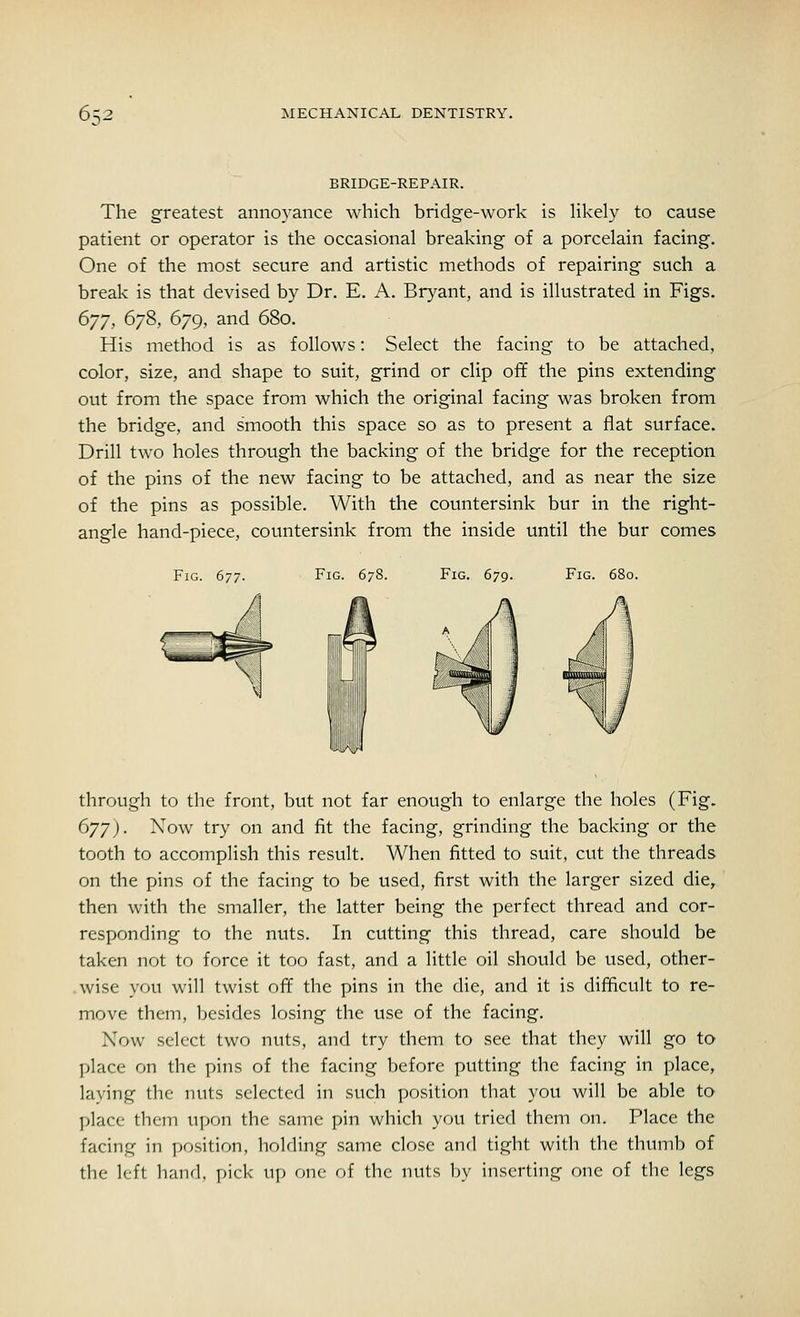 BRIDGE-REPAIR. The greatest annoyance which bridge-work is likely to cause patient or operator is the occasional breaking of a porcelain facing. One of the most secure and artistic methods of repairing such a break is that devised by Dr. E. A. Bryant, and is illustrated in Figs. 6yy, 678, 679, and 680. His method is as follows: Select the facing to be attached, color, size, and shape to suit, grind or clip off the pins extending out from the space from which the original facing was broken from the bridge, and smooth this space so as to present a flat surface. Drill two holes through the backing of the bridge for the reception of the pins of the new facing to be attached, and as near the size of the pins as possible. With the countersink bur in the right- angle hand-piece, countersink from the inside until the bur comes Fig. 677. Fig. 678. Fig. 679. Fig. 680. through to the front, but not far enough to enlarge the holes (Fig. 677J. Now try on and fit the facing, grinding the backing or the tooth to accomplish this result. When fitted to suit, cut the threads on the pins of the facing to be used, first with the larger sized die, then with the smaller, the latter being the perfect thread and cor- responding to the nuts. In cutting this thread, care should be taken not to force it too fast, and a little oil should be used, other- wise you will twist off the pins in the die, and it is difficult to re- move them, besides losing the use of the facing. Now select two nuts, and try them to see that they will go to place on the pins of the facing before putting the facing in place, laving the nuts selected in such position that you will be able to place them upon the same pin which you tried them on. Place the facing in position, holding same close and tight with the thumb of the left hand, pick up one of the nuts by inserting one of the legs