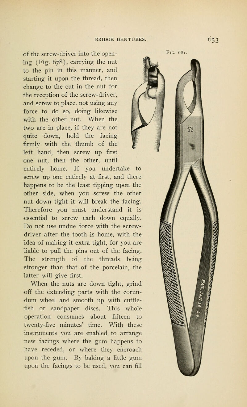 of the screw-driver into the open- ing (Fig. 678), carrying the nut to the pin in this manner, and starting it upon the thread, then change to the cut in the nut for the reception of the screw-driver, and screw to place, not using any force to do so, doing likewise with the other nut. When the two are in place, if they are not quite down, hold the facing firmly with the thumb of the left hand, then screw up first one nut, then the other, until entirely home. If you undertake to screw up one entirely at first, and there happens to be the least tipping upon the other side, when you screw the other nut down tight it will break the facing. Therefore you must understand it is essential to screw each down equally. Do not use undue force with the screw- driver after the tooth is home, with the idea of making it extra tight, for you are liable to pull the pins out of the facing. The strength of the threads being stronger than that of the porcelain, the latter will give first. When the nuts are down tight, grind off the extending parts with the corun- dum wheel and smooth up with cuttle- fish or sandpaper discs. This whole operation consumes about fifteen to twenty-five minutes' time. With these instruments you are enabled to arrange new facings where the gum happens to have receded, or where they encroach upon the gum. By baking a little gum npon the facings to be used, you can fill Fig. 681.