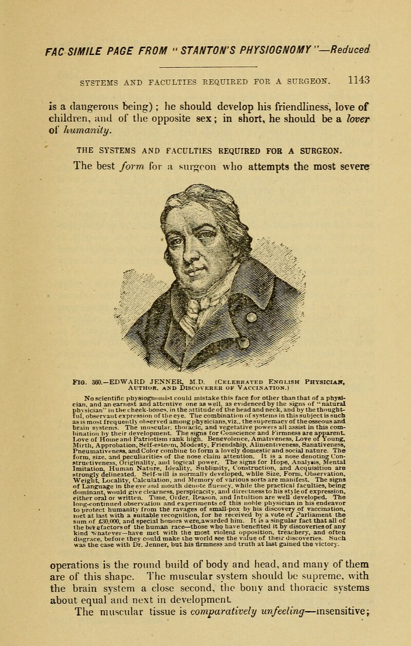 SYSTEMS AND FACULTIES REQUIRED EOE A SURGEOK. 1143 is a dangerous being); he should develop his friendliness, love of cliildven, and of tlie opposite sex; in short, he shoidd be a Icmer of It/amcmiiy, THE SYSTEMS AND FACULTIES REQUIRED FOB A SURGEON. The best form, for a snrgcon who attempts the most severe No scientific physiocnunii^t could mistake this face for other than that of a physi- cian, and an earnest and attentive one aa well, as evidenced by the signs of natural Fhvsician in the cheek-bone^, in thenttitudeof the head and neck, and by the thought- ul, observant expression of the eye. Tlie combination of systems in this subject is such as is most frequeiill> observed among physicians, viz.. the supremacy of the osseous and brain systems. The muscular, thoracic, and vegetative powers all assist in this com- binatioii by their development. The signs for (Conscience and Firmness are apparent. I^ve of Home and Patriotism rank hign. Benevolence, Amaliveness, Love oi Young, Mirth, Approbation, Self-eslet*ni, Modesty, Friendship. Alinientiveness, Sanativenesa, Pneumativenefls. and Color combine to form a lovely domestic and social nature. The form, size, and peculiaritie.-* of the nose claim attention. It is a nose denoting Con- fltmctiveness. Originality, and logical power. The signs for Hope. Analysis, Mental Imitation, Human Nature. Ideality, Sublimity, Construction, and Acquisition are Htrongly delineated. Self-will is normallv developed, while Size. Form. Observation, Weight. Localitv, Calculation, and Memory of various sorts are manifest. The signs of Language in theeveund mouth Ueuute tiuencv, while the practical faculties, bemg dominant, would give clearness, perspicacity, ami directness to his styleof expression, either oral or written. Time. Oider. Reason, and Intuition are well developed. The long-continued observation and experiments of this noble physician in his endeavor to protect huroanitv from the ravages of small-pox by his discovery of vaccination, met at last with a suitable recognition, for he received by a vote of Parliament the sum of £30,000, and special honors wercawarded him, Tt is a singular fact that all of t he beVef actors of the human race—those whg havebenettted it by discoveries of any kind Tvhatever—have met with the most vioIeiU wpposition, treachery, and often di-sgrace. before thev could make the world see the value of their discoveries. Such was the case with Dr. Jenner, but his firmness and truth at last gained the victory. operations is the round build of body and head, and many of them are of this shape. The muscular system should be supreme, with the brain system a close second, the bony and thoracic systems about equal and next in development The muscular tissue is comparatively unfeeling—msensitive;
