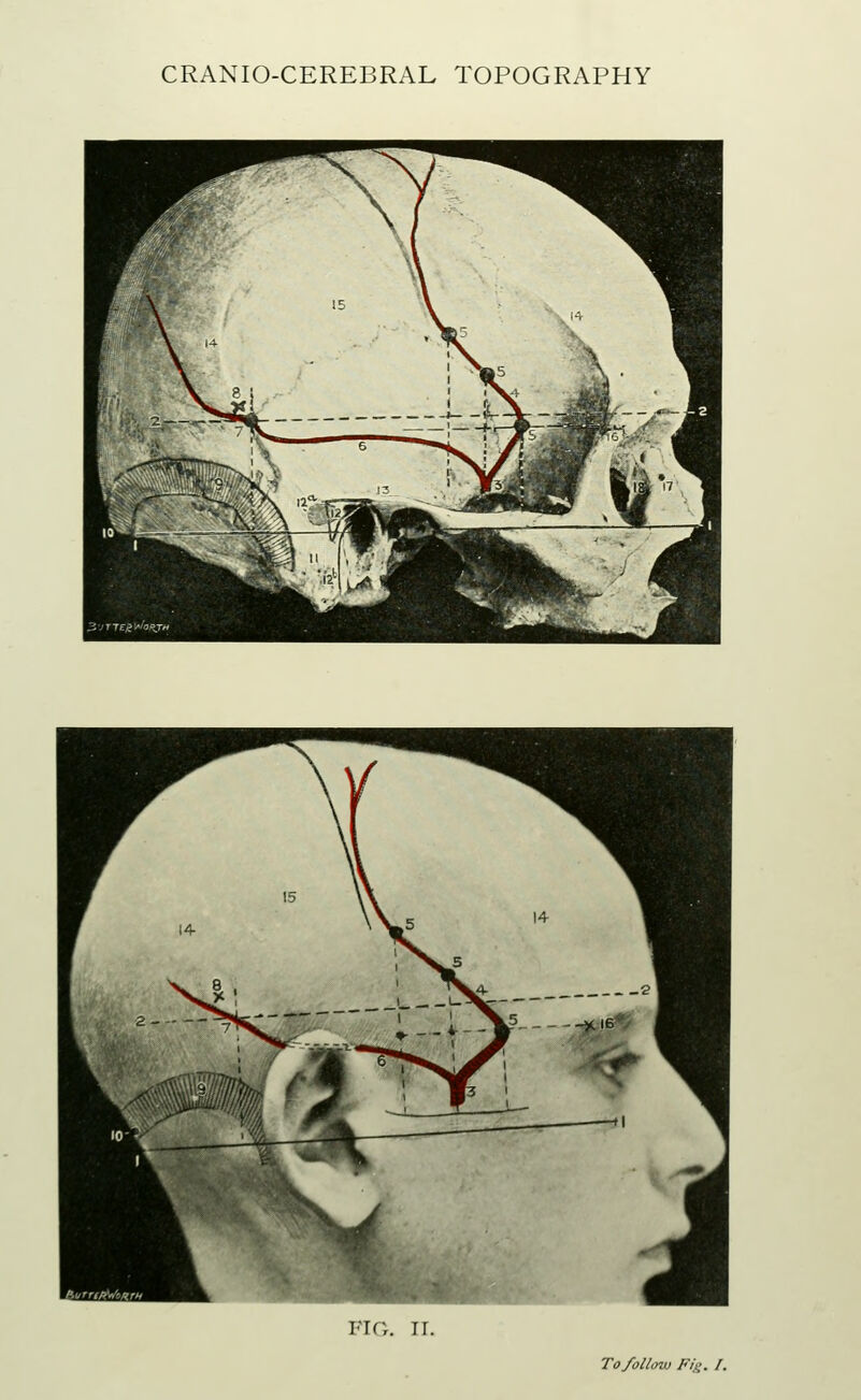 FIG. TI. To follow Fit;. /.