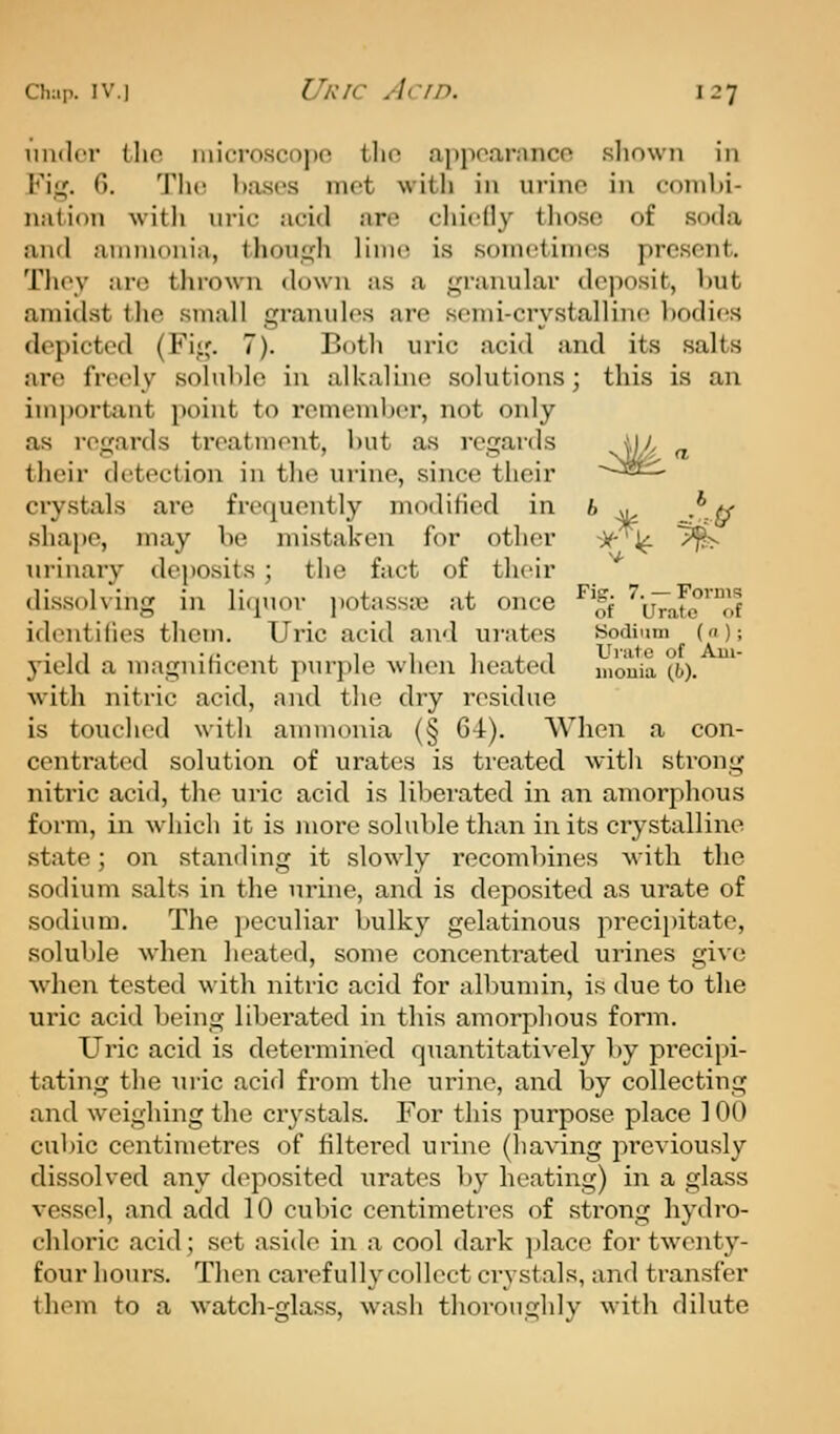 iinilcr (Iio iiiicrnscope tlin appoaranco sliowii in Fig. 6. The l)ases met with in urine in combi- nation with uric acid are chiefly those of soda and ammonia, though lime is sometimes present. They are thi'own down as a granular deposit, but amidst the small granules are semi-crystalline bodi(!S depicted (Fig. 7). Both uric acid and its salts are freely sohible in alkaline solutions; this is an important point to remember, not only as regards treatment, but as regards i]), ^ their detection in the urine, since their --^st:^ ciystals are frequently modified in fc w, .*^ shajie, may be mistaken for other -X^i^ ^ urinary deposits ; the fact of their dissolving in litpior potasste at once ^*|j ^'u7ate'™of identifies them. Uric acid and ui'ates Sodium (a); yield a magnificent purple when heated mouia (6). with nitric acid, and the dry residue is touched with aunnonia (§ 64). When a con- centrated solution of urates is treated with sti-ong nitric acid, the uric acid is liberated in an amorphous form, in which it is more soluble than in its crystalline state; on standing it slowly recombines with the sodium salts in the urine, and is deposited as urate of sodium. The peculiar bulky gelatinous preci})itate, soluble when heated, some concentrated urines give when tested with nitric acid for albumin, is due to the uric acid being liberated in this amorphous form. Uric acid is determined quantitatively by precipi- tating the in-ic acid from the urine, and by collecting and weighing the cr3'stals. For this purpose place 100 cubic centimetres of filtered urine (having previously dissolved any deposited urates by heating) in a glass vessel, and add 10 cubic centimetres of strong hydro- chloric acid; set aside in a cool dark ])lace foi' twenty- four hours. Then carefully collect crystals, and transfer them to a watch-glass, wash thoroughly with dilute