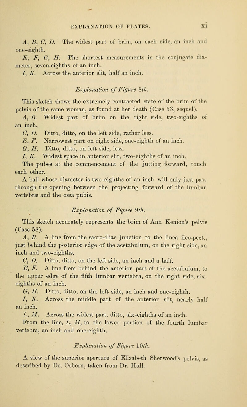 A, B, C, D. Tlie widest part, of brim, on each hIcIg, an inoli .'iiid one-eiglith. E, F, G, II. The shortest measurements in tlie conjugate dia- meter, seven-eighths of an inch. /, K. Across the anterior slit, half an inch. Explanation of Figure Sth. This sketch shows the extremely contracted state of the brim of the pelvis of the same woman, as found at her death (Case 53, sequel). A, B. Widest part of brim on the right side, two-eighths of an inch. C, D. Ditto, ditto, on the left side, rather less. E, F. Narrowest part on right side, one-eighth of an inch. G, II. Ditto, ditto, on left side, less. /, K. Widest space in anterior slit, two-eighths of an inch. The pubes at the commencement of the jutting forward, touch each other. A ball whose diameter is two-eighths of an inch will only just pass through the opening between the projecting forward of the lumbar vertebrse and the ossa pubis. Explanation of Figure 9th. This sketch accurately represents the brim of Ann Kenion's pelvis (Case 58). A, B. A line from the sacro-iliac junction to the linea ileo-pect., just behind the posterior edge of the acetabulum, on the right side, an inch and two-eighths. C, D. Ditto, ditto, on the left side, an inch and a half. i?, F. A line from behind the anterior part of the acetabulum, to the upper edge of the fifth lumbar vertebra, on the right side, six- eighths of an inch. Gi H. Ditto, ditto, on the left side, an inch and one-eighth. 7, K. Across the middle part of the anterior slit, nearly half an inch. Z', M. Across the widest part, ditto, six-eighths of an inch. From the line, L, M, to the lower portion of the fourth lumbar vertebra, an inch and one-eighth. Explanation of Figure 10th. A view of the superior aperture of Elizabeth Sherwood's pelvis, as described by Dr. Osborn, taken from Dr. Hull.