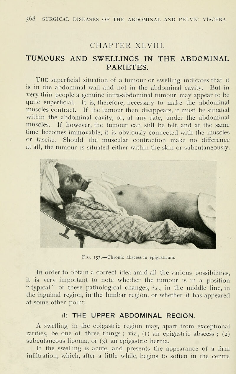 CHAPTER XLVIII. TUMOURS AND SWELLINGS IN THE ABDOMINAL PARIETES. The superficial situation of a tumour or swelling indicates that it is in the abdominal wall and not in the abdominal cavity. But in very thin people a genuine intra-abdominal tumour may appear to be quite superficial. It is, therefore, necessary to make the abdominal muscles contract. If the tumour then disappears, it must be situated within the abdominal cavity, or, at any rate, under the abdominal muscles. If however, the tumour can slill be felt, and at the same time becomes immovable, it is obviously connected with the muscles or fascia?. Should the muscular contraction make no difference at all, the tumour is situated either within the skin or subcutaneously. Fig. 157.—Chronic abscess in epigastrium. In order to obtain a correct idea amid all the various possibilities, it is very important to note whether the tumour is in a position typical of these pathological changes, i.e., in the middle line, in the inguinal region, in the lumbar region, or whether it has appeared at some other point. (1) THE UPPER ABDOMINAL REGION. A swelling in the epigastric region may, apart from exceptional rarities, be one of three things ; viz., (i) an epigastric abscess ; (2) subcutaneous lipoma, or (3) an epigastric hernia. If the swelling is acute, and presents the appearance of a firm infiltration, which, after a little while, begins to soften in the centre