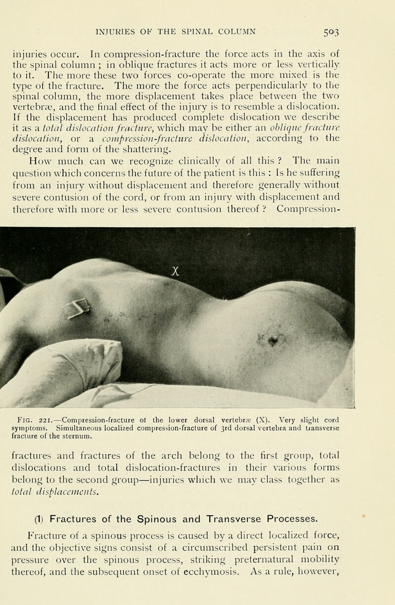 injuries occur. In compression-fracture the force acts in the axis of the spinal column ; in oblique fractures it acts more or less vertically to it. The more these two forces co-operate the more mixed is the type of the fracture. The more the force acts perpendicularly to the spinal column, the more displacement takes place between the two vertebrae, and the final effect of the injury is to resemble a dislocation. If the displacement has produced complete dislocation we describe it as a total dislocation fracture, which may be either an oblique fracture dislocation, or a compression-fracture dislocation, according to the degree and form of the shattering. How much can we recognize clinically of all this ? The main question which concerns the future of the patient is this : Is he suffering from an injury without displacement and therefore generally without severe contusion of the cord, or from an injury with displacement and therefore with more or less severe contusion thereof ? Compression- FlG. 221.—Compression-fracture ot the lower dorsal vertebrae (X). Very slight cord symptoms. Simultaneous localized compression-fracture of 3rd dorsal vertebra and transverse fracture of the sternum. fractures and fractures of the arch belong to the first group, total dislocations and total dislocation-fractures in their various forms belong to the second group—injuries which we may class together as total displacements. (1) Fractures of the Spinous and Transverse Processes. Fracture of a spinous process is caused by a direct localized force, and the objective signs consist of a circumscribed persistent pain on pressure over the spinous process, striking preternatural mobility thereof, and the subsequent onset of ecchymosis. As a rule, however.