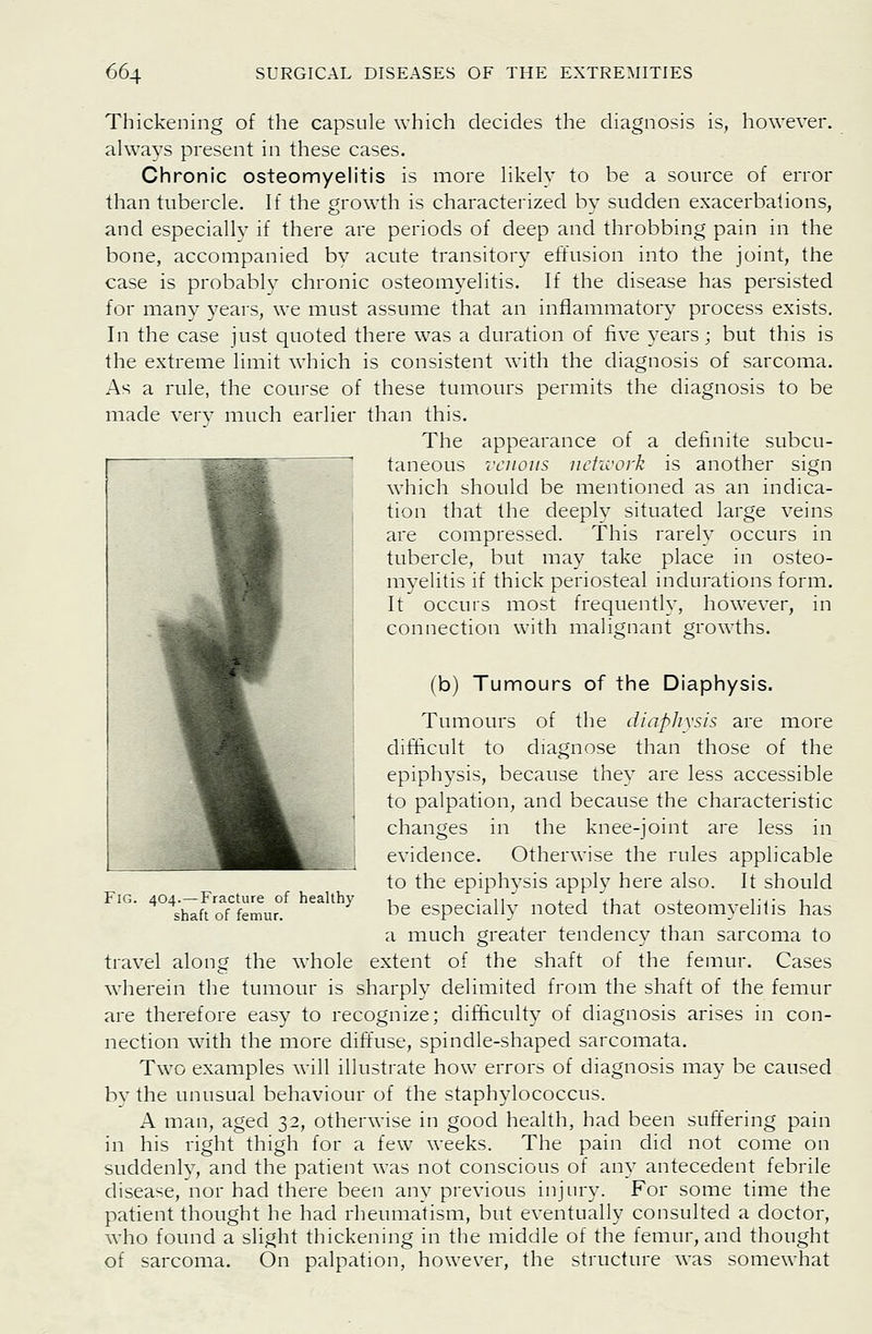 Thickening of the capsule which decides the diagnosis is, however, always present in these cases. Chronic osteomyelitis is more likely to be a source of error than tubercle. If the growth is characterized by sudden exacerbations, and especially if there are periods of deep and throbbing pain in the bone, accompanied by acute transitory effusion into the joint, the case is probably chronic osteomyelitis. If the disease has persisted for many years, we must assume that an inflammatory process exists. In the case just quoted there was a duration of live years j but this is the extreme limit which is consistent with the diagnosis of sarcoma. As a rule, the course of these tumours permits the diagnosis to be made verv much earlier than this. The appearance of a definite subcu- taneous venous nehvork is another sign which should be mentioned as an indica- tion that the deepiv situated large veins are compressed. This rareh' occurs in tubercle, but may take place in osteo- myelitis if thick periosteal indurations form. It occurs most frequently, however, in connection with malignant growths. Fig. 404.—Fracture of healthy shaft of femur. (b) Tumours of the Diaphysis. Ttimours of the diaphvsis are more difficult to diagnose than those of the epiphysis, because they are less accessible to palpation, and because the characteristic changes in the knee-joint are less in evidence. Otherwise the rules applicable to the epiphysis apply here also. It should be especially noted that osteomyelitis has a much greater tendency than sarcoma to travel along the whole extent of the shaft of the femur. Cases wherein the tumour is sharply delimited from the shaft of the femur are therefore easy to recognize; difficulty of diagnosis arises in con- nection wdth the more diffuse, spindle-shaped sarcomata. Tw^o examples will illustrate how errors of diagnosis may be caused by the unusual behaviour of the staphylococcus. A man, aged 32, otherwise in good health, had been suffering pain in his right thigh for a few weeks. The pain did not come on suddenly, and the patient was not conscious of any antecedent febrile disease, nor had there been any previous injury. For some time the patient thought he had rheumatism, but eventually consulted a doctor, who found a slight thickening in the middle of the femur, and thought of sarcoma. On palpation, however, the structure was somewhat