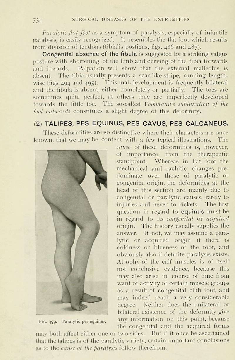 Patalxtic flat foot as a symptom of paralysis, especially of infantile paralysis, is easily recognized. It resembles the flat foot which results from division of tendons (tibialis posticus, figs. 486 and 487). Congenital absence of the fibula is suggested by a striking valgus posture with shortening of the limb and curving of the tibia forwards and inwards. Palpation will show that the external malleolus is absent. The tibia usuall}^ presents a scar-like stripe, running length- wise (figs. 494 and 495). This mal-development is frequently bilateral and the fibula is absent, either completely or partially. The toes are sometimes quite perfect, at others they are imperfectly developed towards the little toe. The so-called Volkiuaiin's subluxation of tlic foot outwards constitutes a slight degree of this deformity. (2) TALIPES, PES EQUINUS, PES CAVUS, PES CALCANEUS. These deformities are so distinctive where their characters are once known, that we may be content with a few typical illustrations. The cause of these deformities is, howevei, of importance, from the therapeutic standpoint. Whereas in flat foot the mechanical and rachitic changes pre- dominate over those of paralytic or congenital origin, the deformities at the head of this section are mainly due to congenital or paralytic causes, rarely to injuries and never to rickets. The first question in regard to equinus must be in regard to its congenital or acquired \ ^ ^ origin. The history usually supplies the answer. If not, we may assuine a para- lytic or acquired origin if there is coldness or blueness of the foot, and obviously also if definite paralysis exists. Atrophy of the calf muscles is of itself not conclusive evidence, because this may also arise in course of time from want of activity of certain muscle groups as a result of congenital club foot, and may indeed reach a very considerable degree. Neither does the unilateral or bilateral existence of the deformity give any information on this point, because the congenital and the acquired forms may both affect either one or two sides. But if it once be ascertained that the talipes is of the paralytic variety, certain important conclusions as to the cause of the paralysis follow therefrom. Fig. 499. — Paralytic pes equinu?