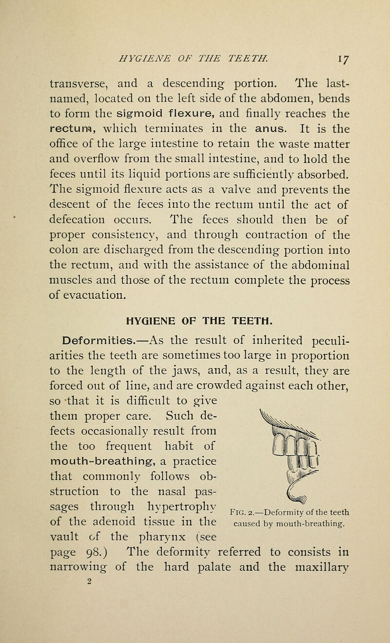 HYGIENE OF THE TEETH. 1/ transverse, and a descending portion. The last- named, located on the left side of the abdomen, bends to form the sigmoid flexure, and finally reaches the rectum, which terminates in the anus. It is the office of the large intestine to retain the waste matter and overflow from the small intestine, and to hold the feces until its liquid portions are sufficiently absorbed. The sigmoid flexure acts as a valve and prevents the descent of the feces into the rectum until the act of defecation occurs. The feces should then be of proper consistency, and through contraction of the colon are discharged from the descending portion into the rectum, and with the assistance of the abdominal muscles and those of the rectum complete the process of evacuation. HYGIENE OF THE TEETH. Deformities.—As the result of inherited peculi- arities the teeth are sometimes too large in proportion to the length of the jaws, and, as a result, they are forced out of line, and are crowded against each other, so -that it is difficult to give them proper care. Such de- fects occasionally result from the too frequent habit of mouth-breatining, a practice that commonly follows ob- struction to the nasal pas- ^ sages through hypertrophy Pj^.^^Deformii^of the teeth of the adenoid tissue in the caused by mouth-breathing. vault of the pharynx (see page 98.) The deformity referred to consists in narrowing of the hard palate and the maxillary