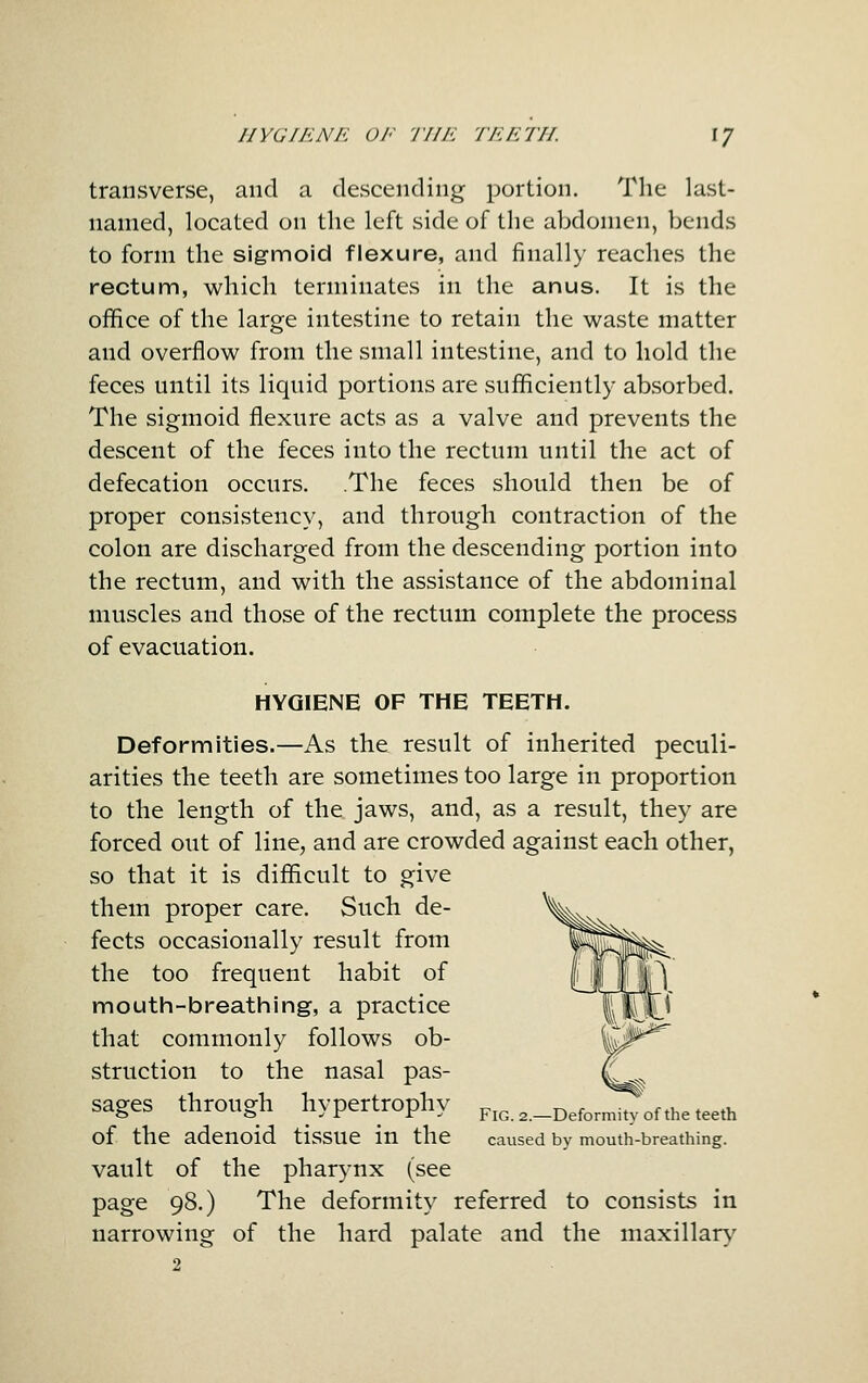 HYGIKNE OF 'J'IIE TEETH. IJ transverse, and a descending portion. The last- named, located on the left side of the abdomen, bends to form the sigmoid flexure, and finally reaches the rectum, which terminates in the anus. It is the office of the large intestine to retain the waste matter and overflow from the small intestine, and to hold the feces until its liquid portions are sufficiently absorbed. The sigmoid flexure acts as a valve and prevents the descent of the feces into the rectum until the act of defecation occurs. The feces should then be of proper consistency, and through contraction of the colon are discharged from the descending portion into the rectum, and with the assistance of the abdominal muscles and those of the rectum complete the process of evacuation. HYGIENE OF THE TEETH. Deformities.—As the result of inherited peculi- arities the teeth are sometimes too large in proportion to the length of the jaws, and, as a result, they are forced out of line, and are crowded against each other, so that it is difficult to give them proper care. Such de- fects occasionally result from the too frequent habit of mouth-breathing, a practice that commonly follows ob- struction to the nasal pas- ^ sages through hypertrophy FiG.2.-Deformi^of the teeth of the adenoid tissue in the caused by mouth-breathing. vault of the pharynx (see page 98.) The deformity referred to consists in narrowing of the hard palate and the maxillary