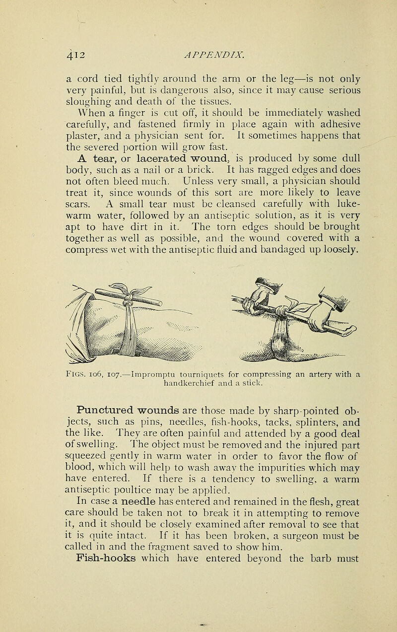 a cord tied tightly around the arm or the leg—is not only very painful, but is dangerous also, since it may cause serious sloughing and death of the tissues. When a finger is cut off, it should be immediately washed carefully, and fastened firmly in place again with adhesive plaster, and a ph}^sician sent for. It sometimes happens that the severed portion will grow fast. A tear, or lacerated wound, is produced by some dull body, such as a nail or a brick. It has ragged edges and does not often bleed much. Unless very small, a physician should treat it, since wounds of this sort are more likely to leave scars. A small tear must be cleansed carefully with luke- warm water, followed by an antiseptic solution, as it is very apt to have dirt in it. The torn edges should be brought together as well as possible, and the wound covered with a compress wet with the antiseptic fluid and bandaged up loosely. Figs. io6, 107.—Impromptu tourniquets for compressing an artery with handkerchief and a stick. handkerchief and a stick. Punctured wounds are those made by sharp-pointed ob- jects, such as pins, needles, fish-hooks, tacks, splinters, and the like. They are often painful and attended by a good deal of swelling. The object must be removed and the injured part squeezed gently in warm water in order to favor the flow of blood, which will help to wash away the impurities which may have entered. If there is a tendency to swelling, a warm antiseptic poultice may be applied. In case a needle has entered and remained in the flesh, great care should be taken not to break it in attempting to remove it, and it should be closely examined after removal to see that it is quite intact. If it has been broken, a surgeon must be called in and the fragment saved to show him. Fish-hooks which have entered beyond the barb must