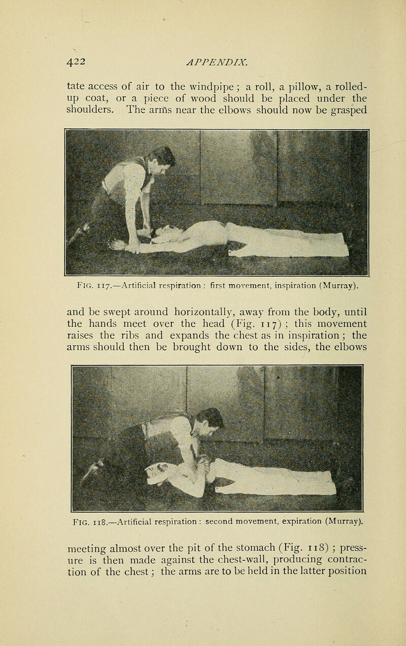 tate access of air to the windpipe; a roll, a pillow, a rolled- up coat, or a piece of wood should be placed under the shoulders. The arms near the elbows should now be grasped Fig. 117.—Artificial respiration : first movement, inspiration (Murray). and be swept around horizontally, away from the body, until the hands meet over the head (Fig. 117) ; this movement raises the ribs and expands the chest as in inspiration; the arms should then be brought down to the sides, the elbows Fig. 118.—Artificial respiration: second movement, expiration (Murray). meeting almost over the pit of the stomach (Fig. 118) ; press- ure is then made against the chest-wall, producing contrac- tion of the chest; the arms are to be held in the latter position