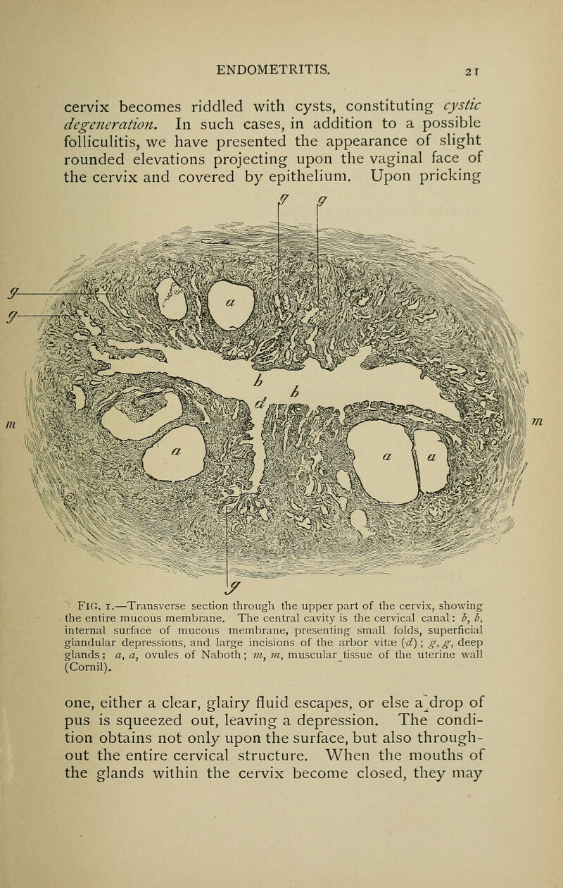 cervix becomes riddled with cysts, constituting cystic degeneration. In such cases, in addition to a possible folliculitis, we have presented the appearance of slight rounded elevations projecting upon the vaginal face of the cervix and covered by epithelium. Upon pricking ■ Fic;. I.—Transverse section through the upper part of the cervix, showing . the entire mucous membrane. The central cavity is the cervical canal: b, b, internal surface of mucous membrane, presenting small folds, superficial glandular depressions, and large incisions of the arbor vitse {d); ^,g, deep glands; a, a, ovules of Naboth; m., in, musculartissue of the uterine wall (Cornil). one, either a clear, glairy fluid escapes, or else a drop of pus is squeezed out, leaving a depression. The condi- tion obtains not only upon the surface, but also through- out the entire cervical structure. When the mouths of the glands within the cervix become closed, they may