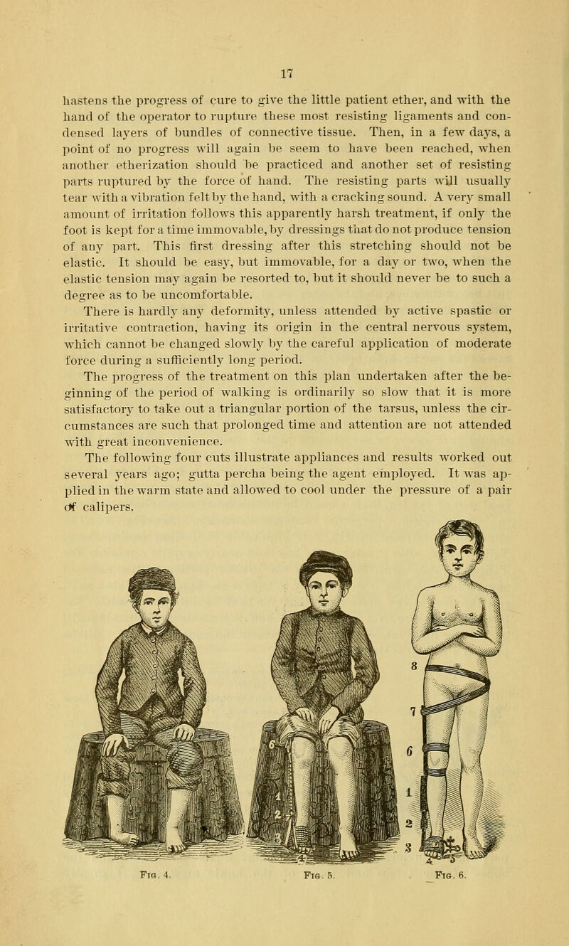 hastens the progress of cure to give the little patient ether, and with the hand of the operator to rupture these most resisting ligaments and con- densed layers of bundles of connective tissue. Then, in a few days, a point of no progress will again be seem to have been reached, when another etherization should be practiced and another set of resisting parts ruptured by the force of hand. The resisting parts will usually tear with a vibration felt by the hand, with a cracking sound. A very small amount of irritation follows this apparently harsh treatment, if only the foot is kept for a time immovable, by dressings that do not produce tension of any part. This first dressing after this stretching should not be elastic. It should be easy, but immovable, for a day or two, when the elastic tension may again be resorted to, but it should never be to such a degree as to be uncomfortable. There is hardly any deformity, unless attended by active spastic or irritative contraction, having its origin in the central nervous system, which cannot be changed slowly by the careful application of moderate force during a sufficiently long period. The progress of the treatment on this plan undertaken after the be- ginning of the period of walking is ordinarily so slow that it is more satisfactory to take out a triangular portion of the tarsus, unless the cir- cumstances are such that prolonged time and attention are not attended with great inconvenience. The following four cuts illustrate appliances and results worked out several years ago; gutta percha being the agent employed. It was ap- plied in the warm state and allowed to cool under the pressure of a pair df calipers. Fig. 5. Fig. 6.